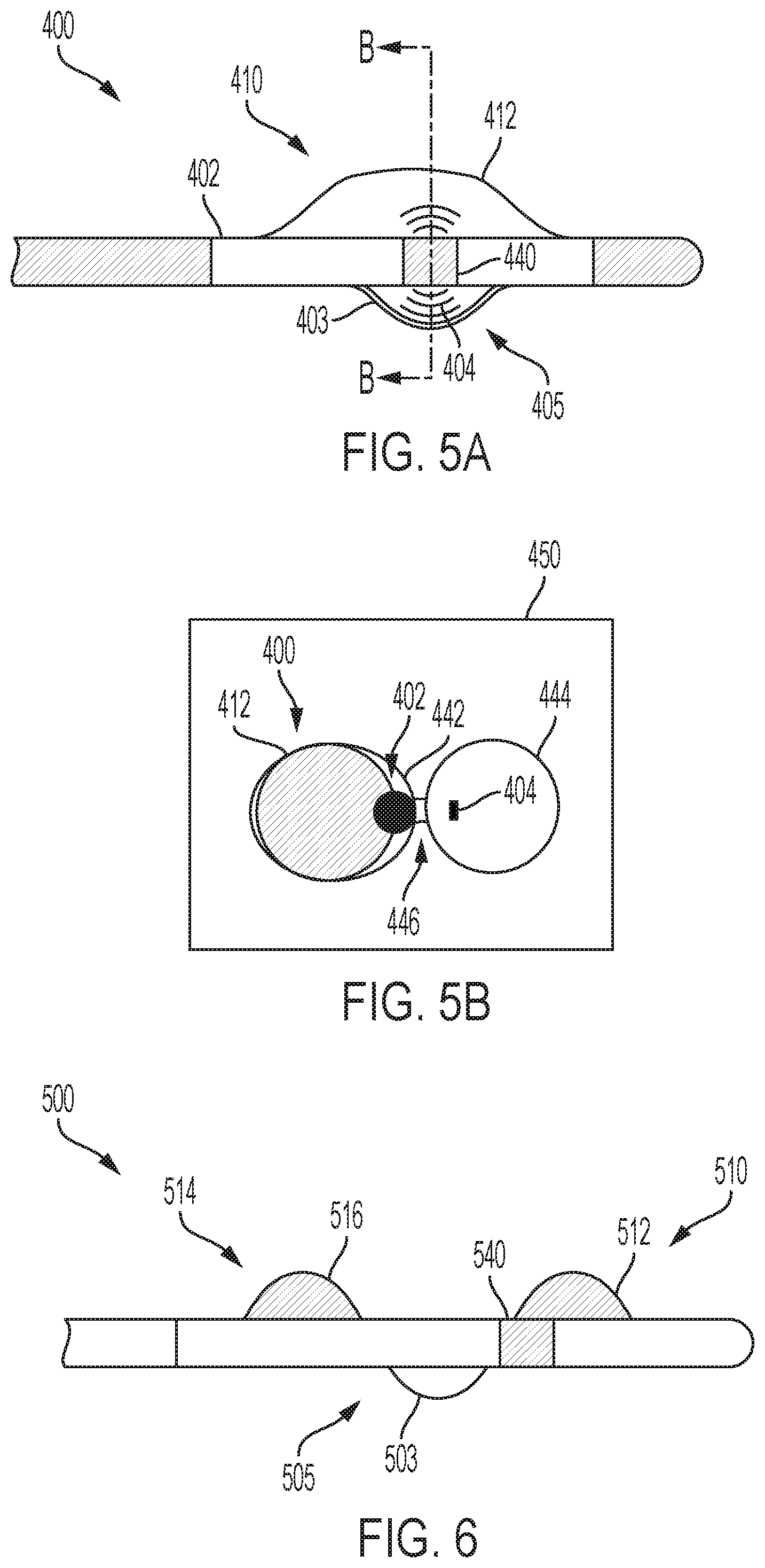 Patent US12167896 Figure 5 – Systems, methods, and catheters for endovascular treatment of a blood vessel