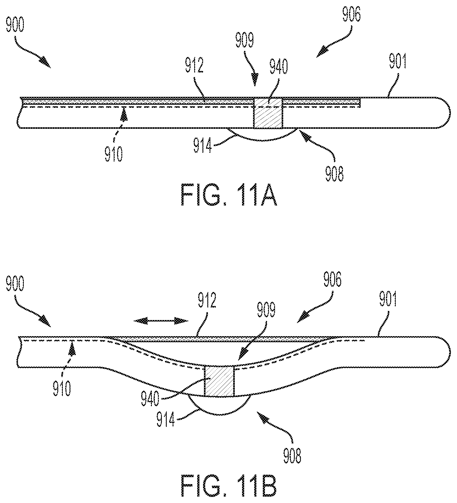 Patent US12167896 Figure 8 – Systems, methods, and catheters for endovascular treatment of a blood vessel