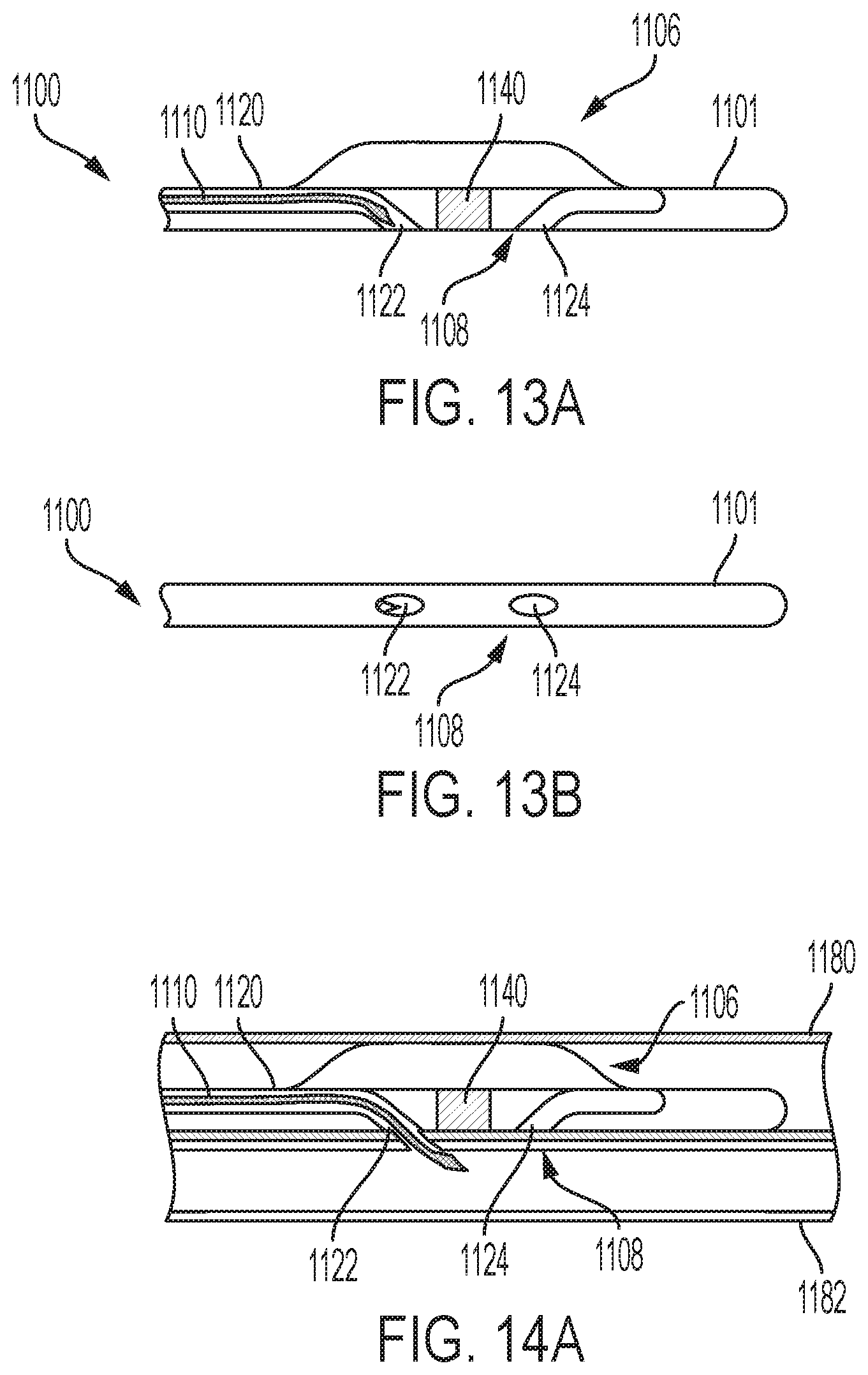 Patent US12167896 Figure 10 – Systems, methods, and catheters for endovascular treatment of a blood vessel