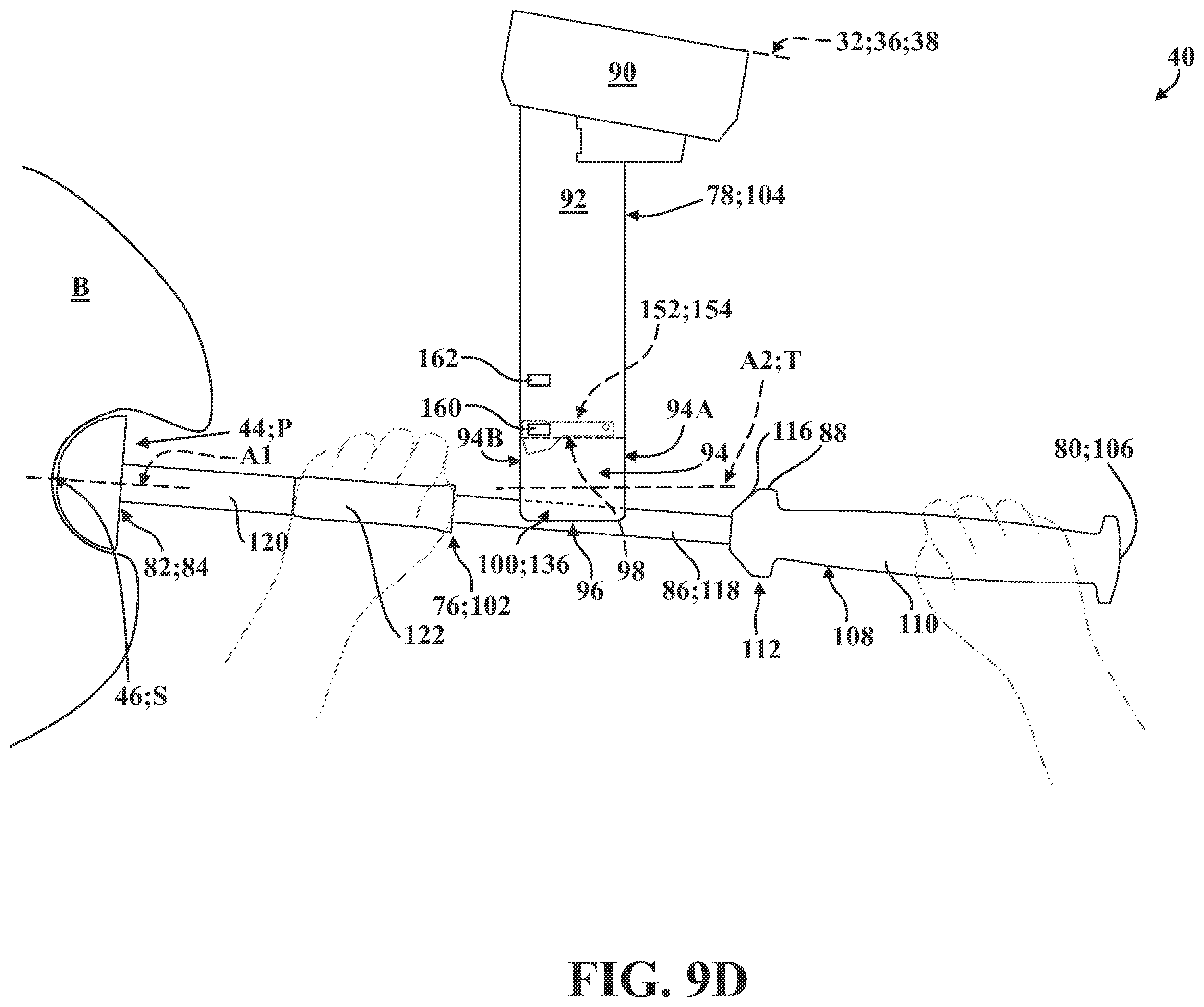 Patent US12167899 Figure 15 – Systems, methods, and end effectors for guiding prostheses
