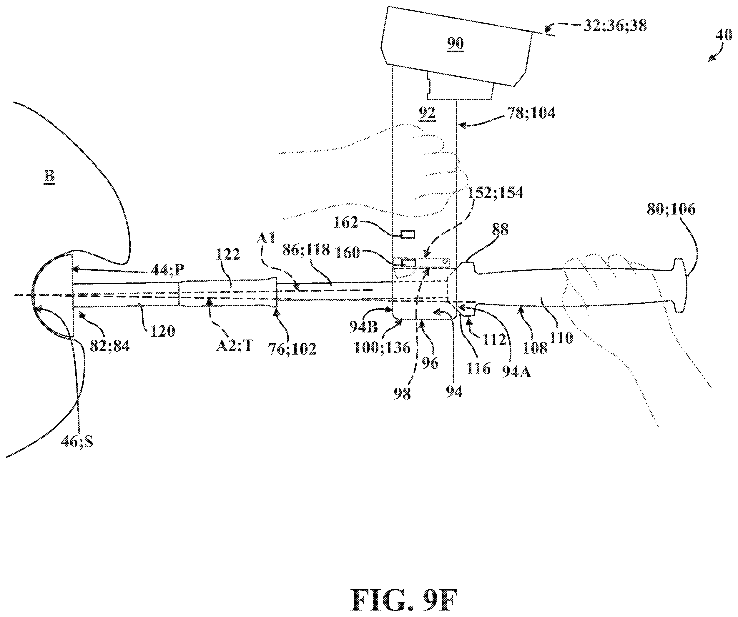 Patent US12167899 Figure 17 – Systems, methods, and end effectors for guiding prostheses