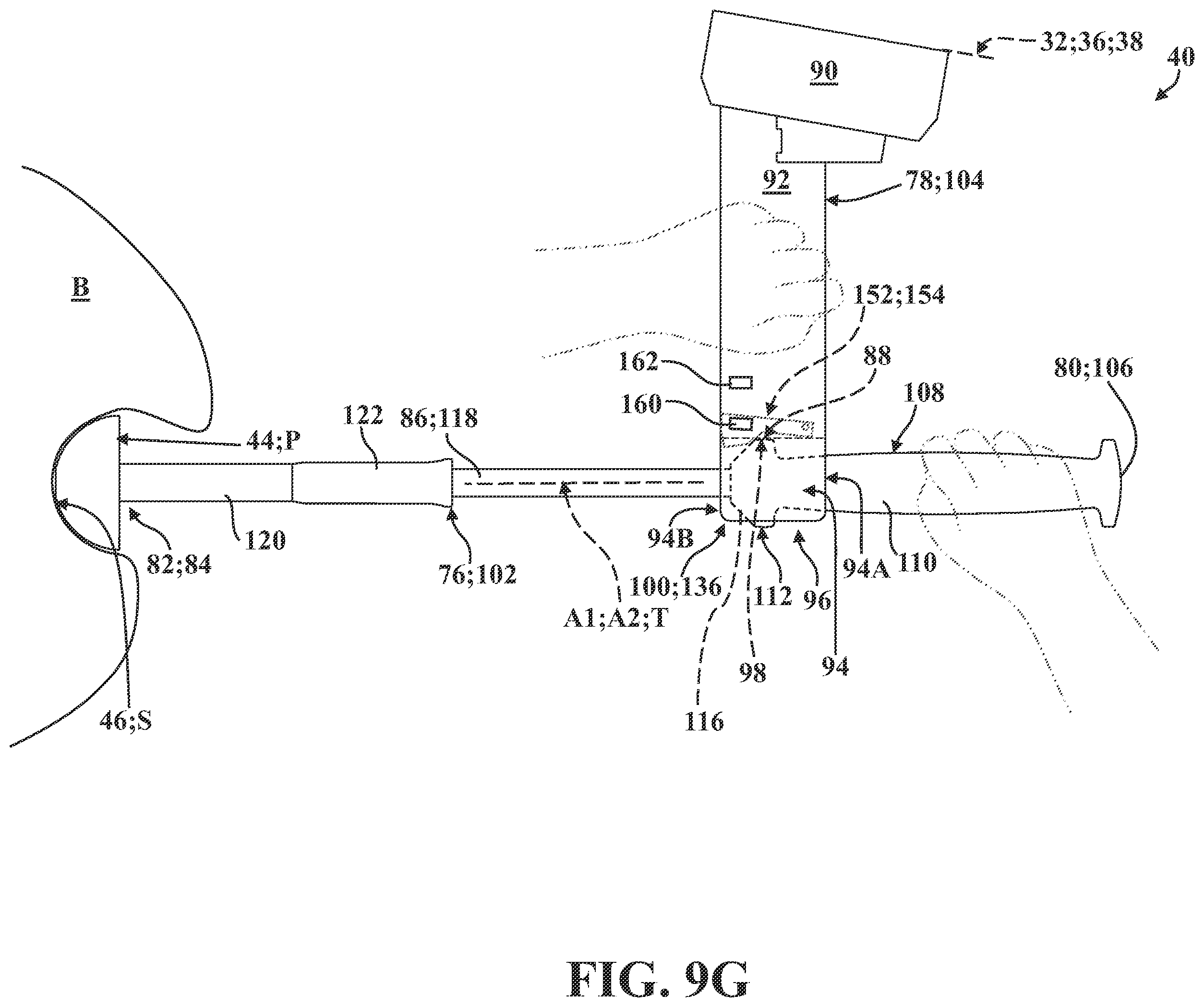Patent US12167899 Figure 18 – Systems, methods, and end effectors for guiding prostheses