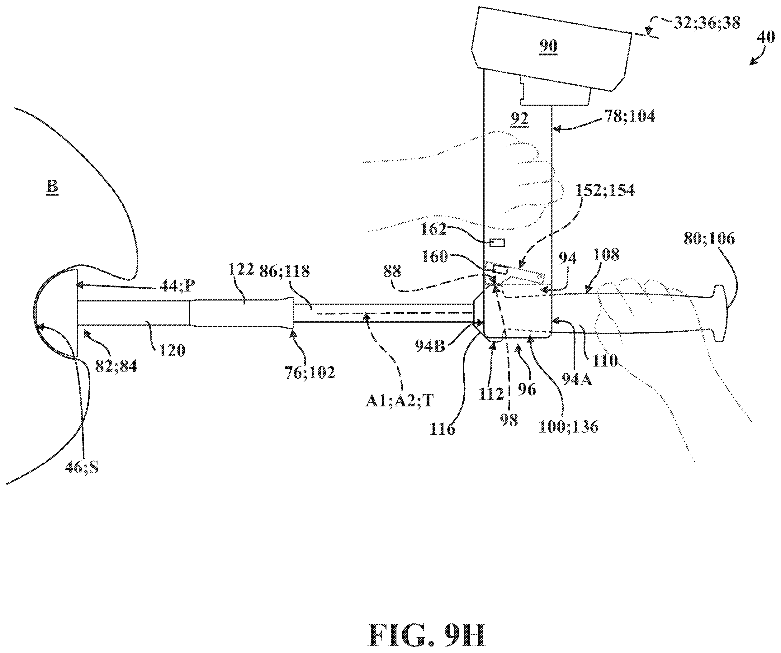 Patent US12167899 Figure 19 – Systems, methods, and end effectors for guiding prostheses