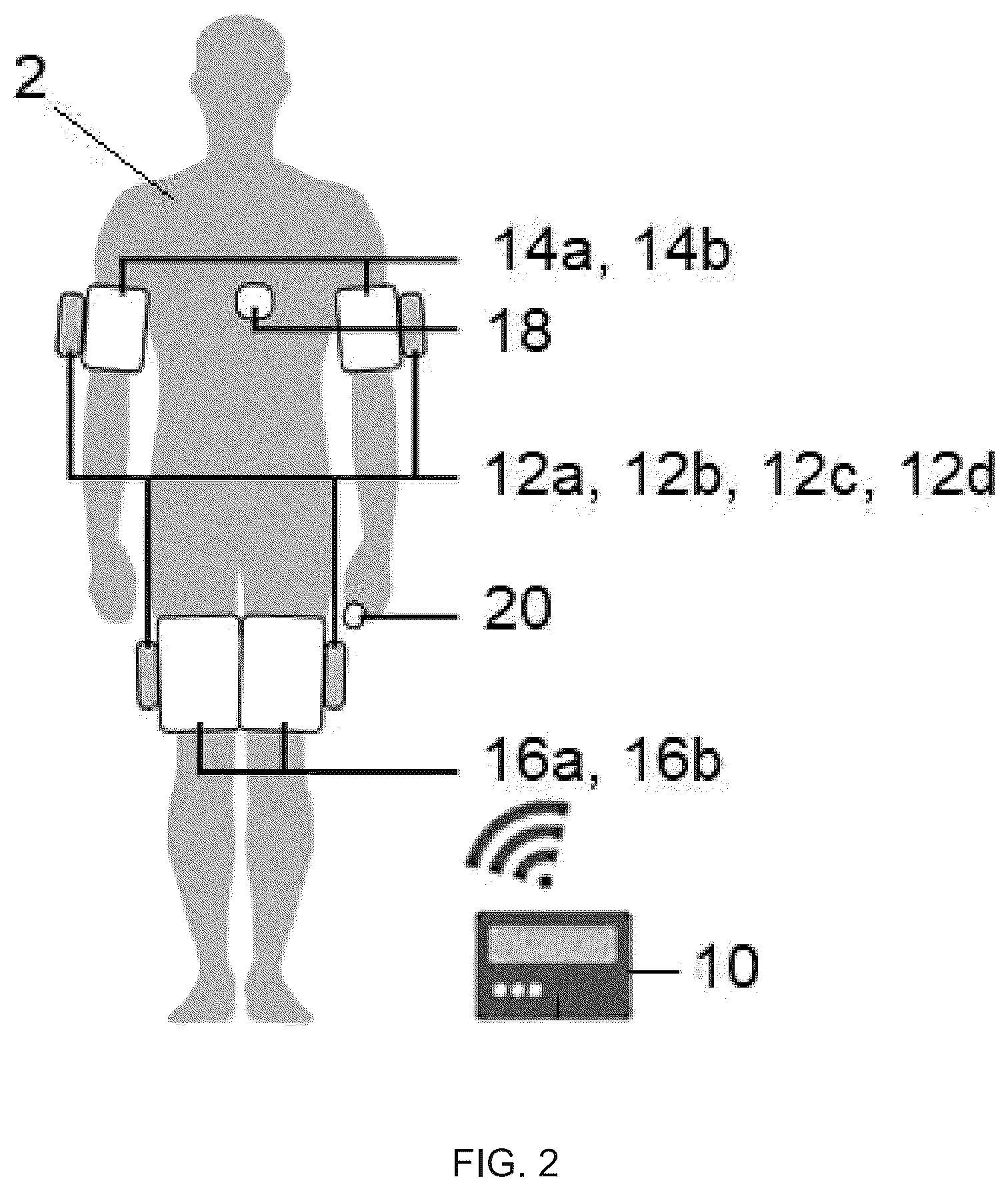 Patent US12167907 Figure 2 – Wireless system and methods for remote ischemic conditioning, external counterpulsation, other cuff-based therapies, and patient monitoring