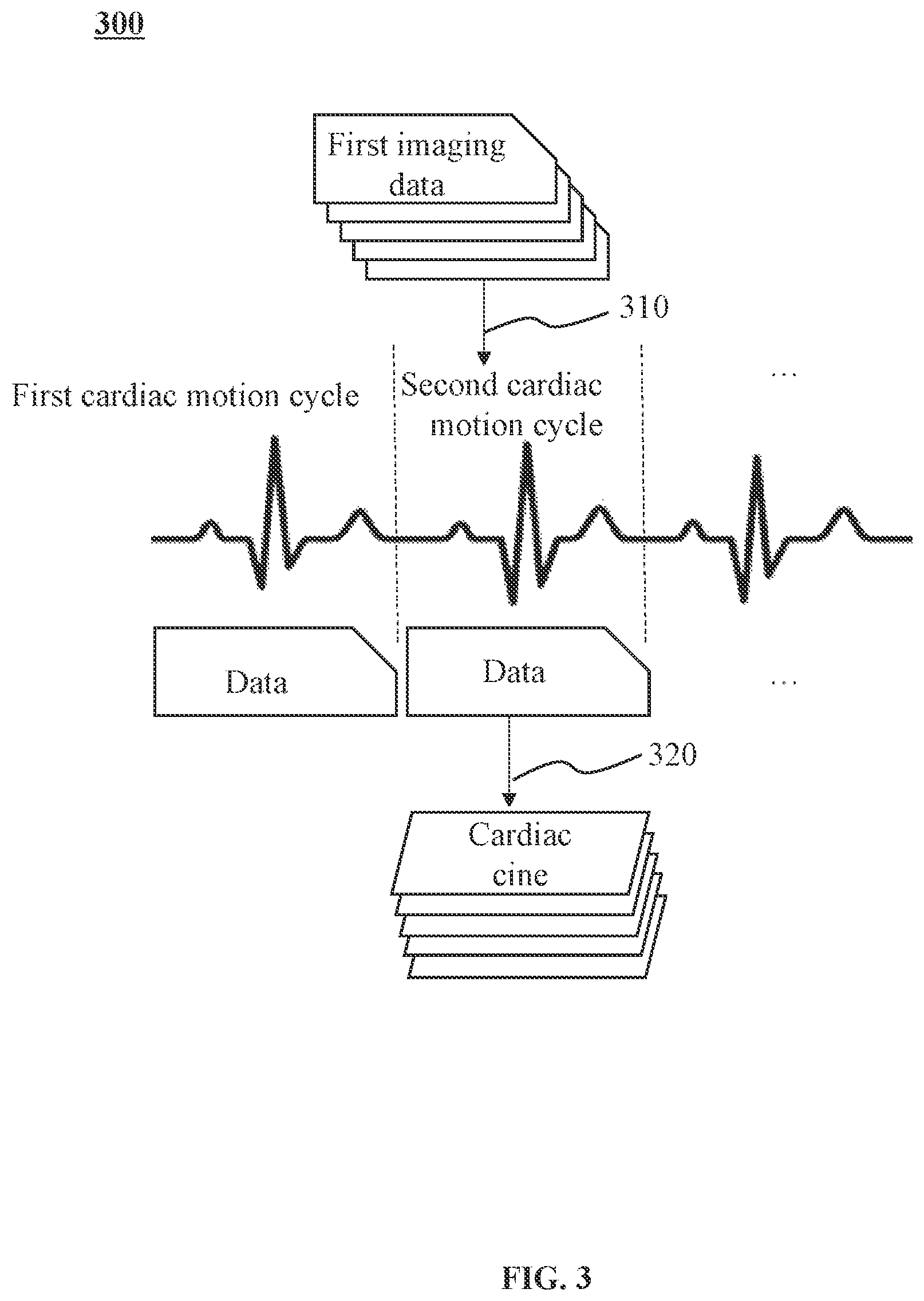 Patent US12167909 Figure 3 – Method and system for magnetic resonance imaging