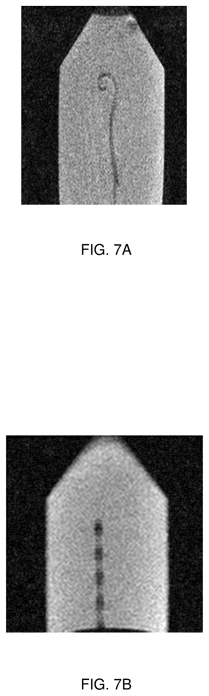 Patent US12167910 Figure 7 – Method, system and apparatus for image-guided insertion of implant devices