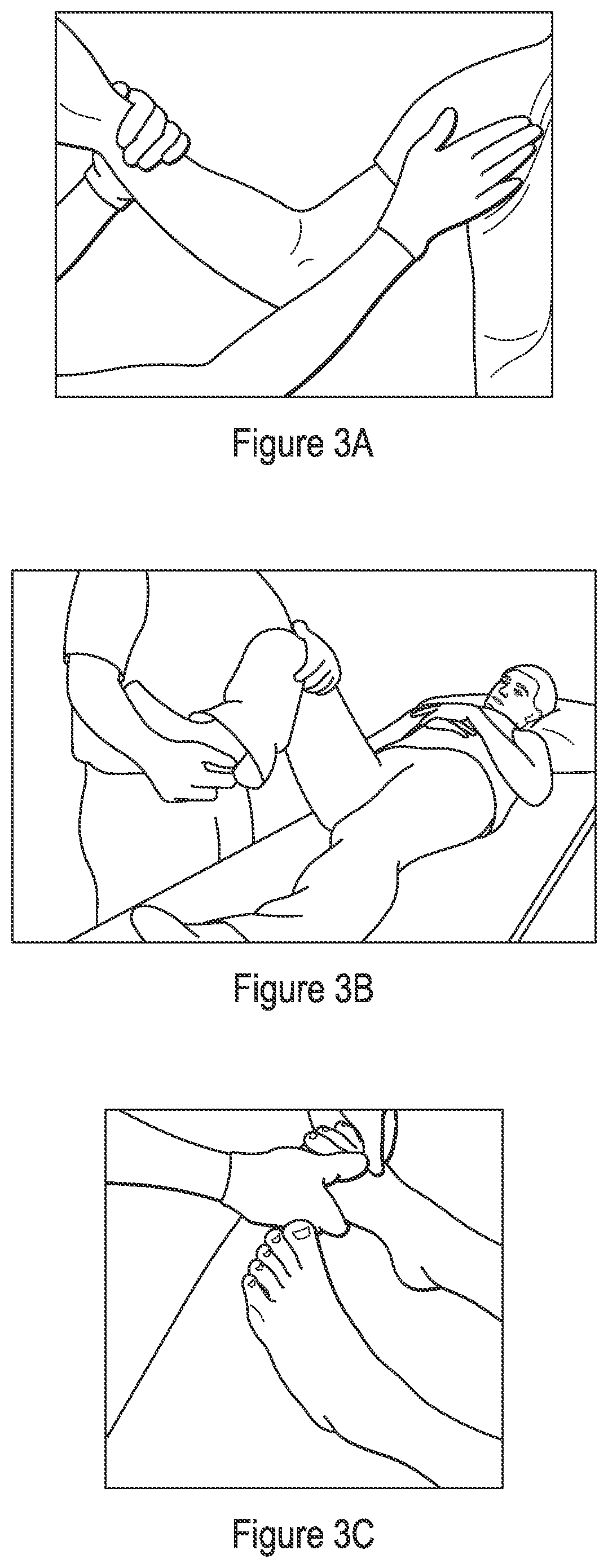 Patent US12167911 Figure 3 – Method and apparatus for muscle tone and limb movement measurement and assessment