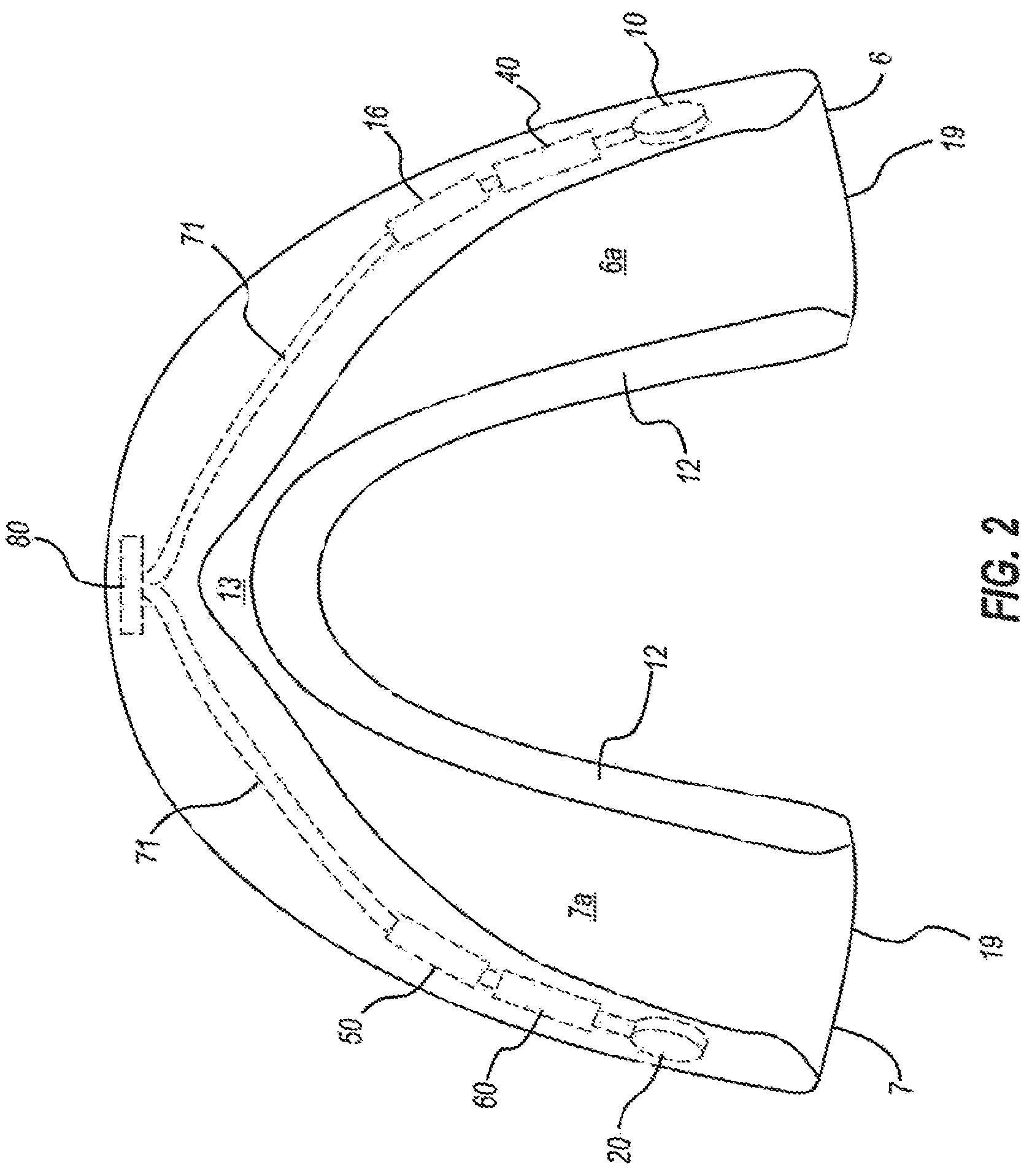 Patent US12167912 Figure 2 – Impact sensing wearable device and method