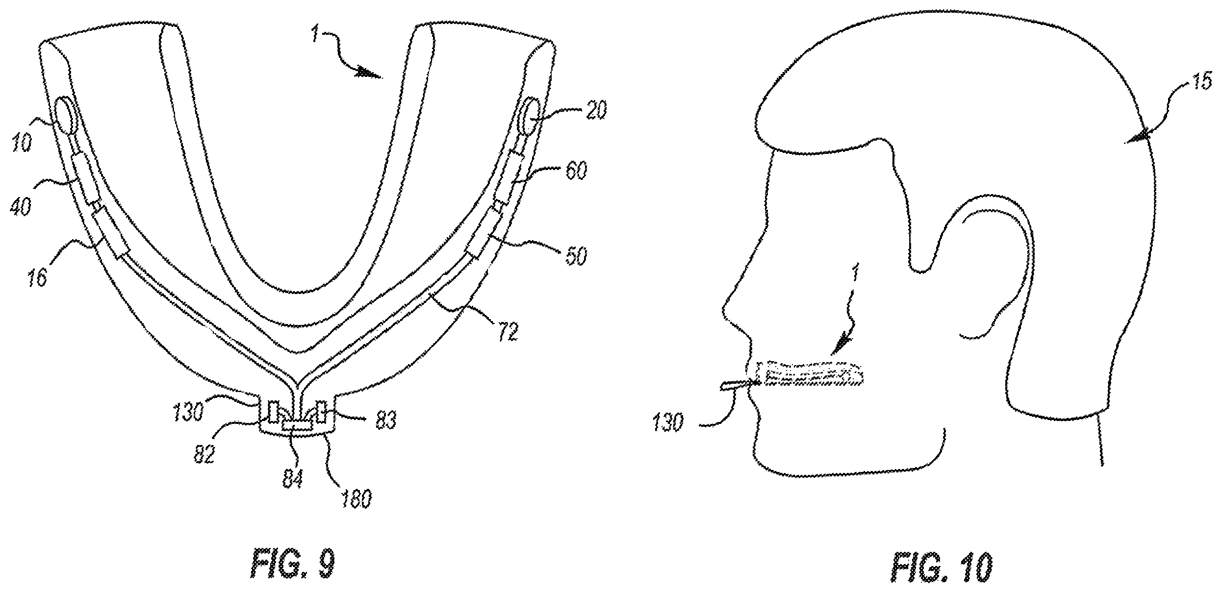 Patent US12167912 Figure 7 – Impact sensing wearable device and method