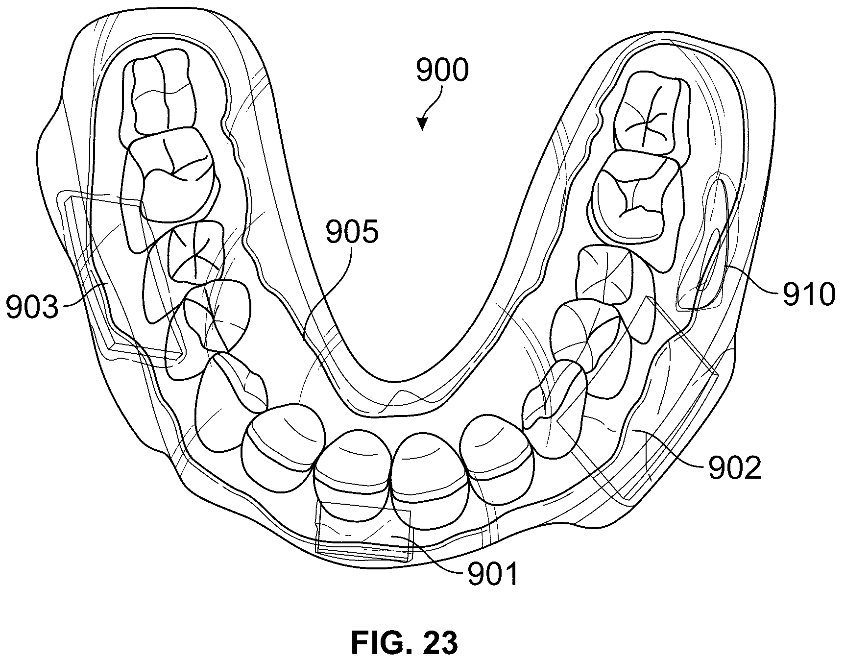 Patent US12167912 Figure 14 – Impact sensing wearable device and method