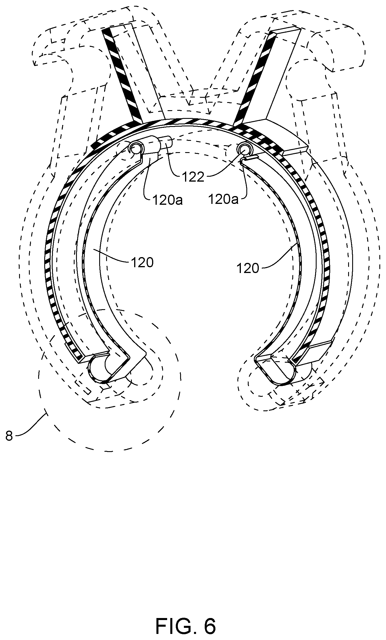 Patent US12167915 Figure 5 – Bipolar nerve stimulation/monitoring cuff
