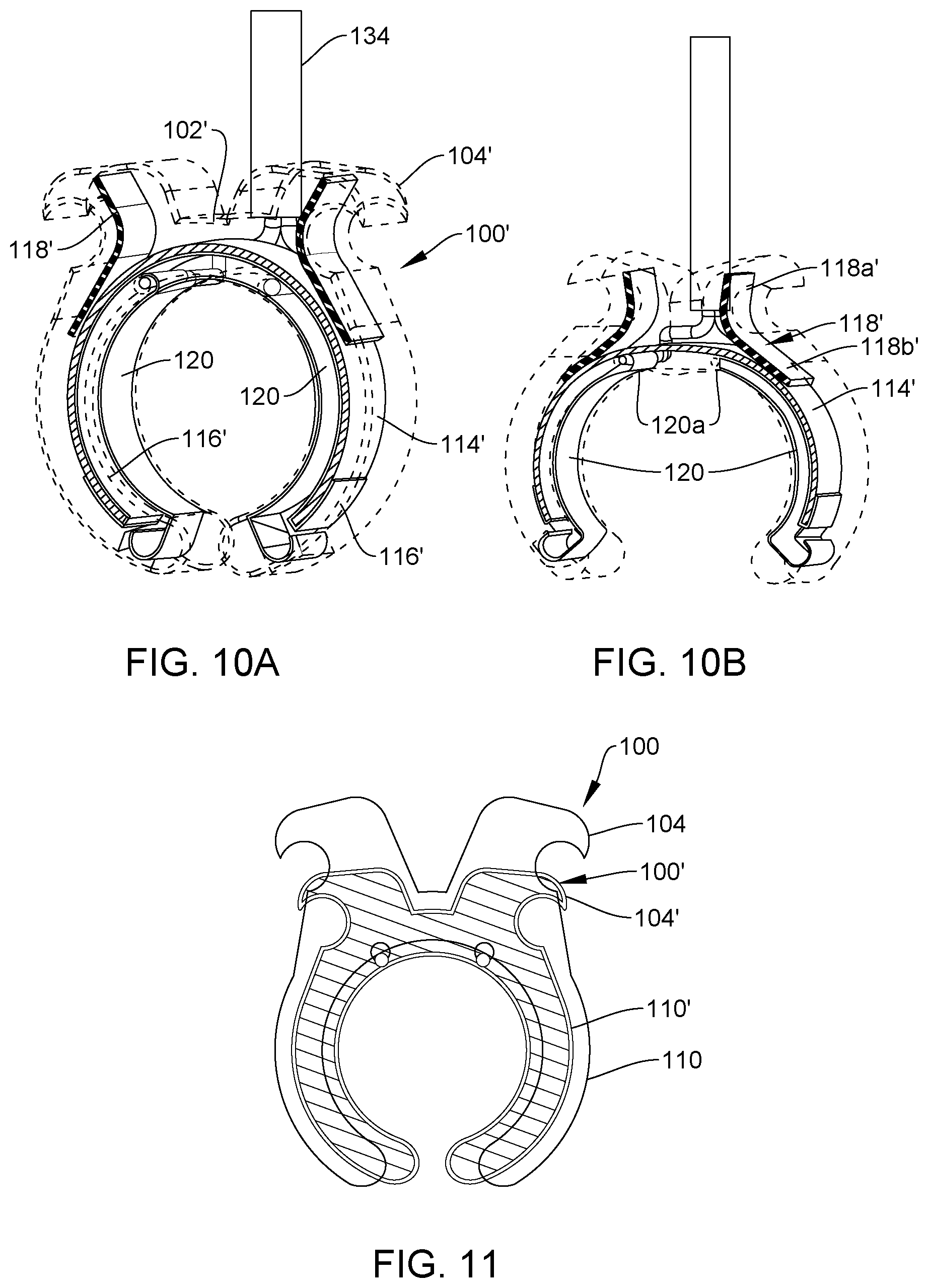 Patent US12167915 Figure 8 – Bipolar nerve stimulation/monitoring cuff