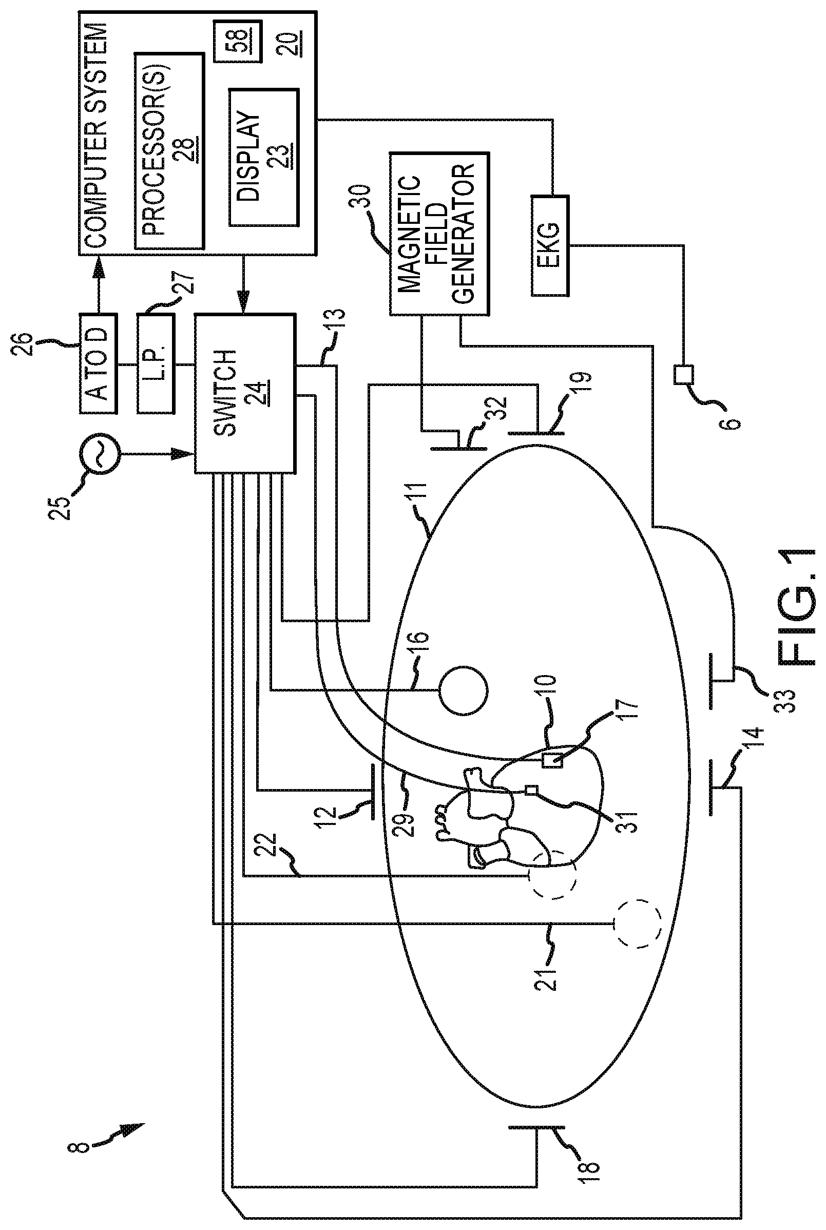 Patent US12167917 Figure 1 – System and method for detection and mapping of near field conduction in scar tissue