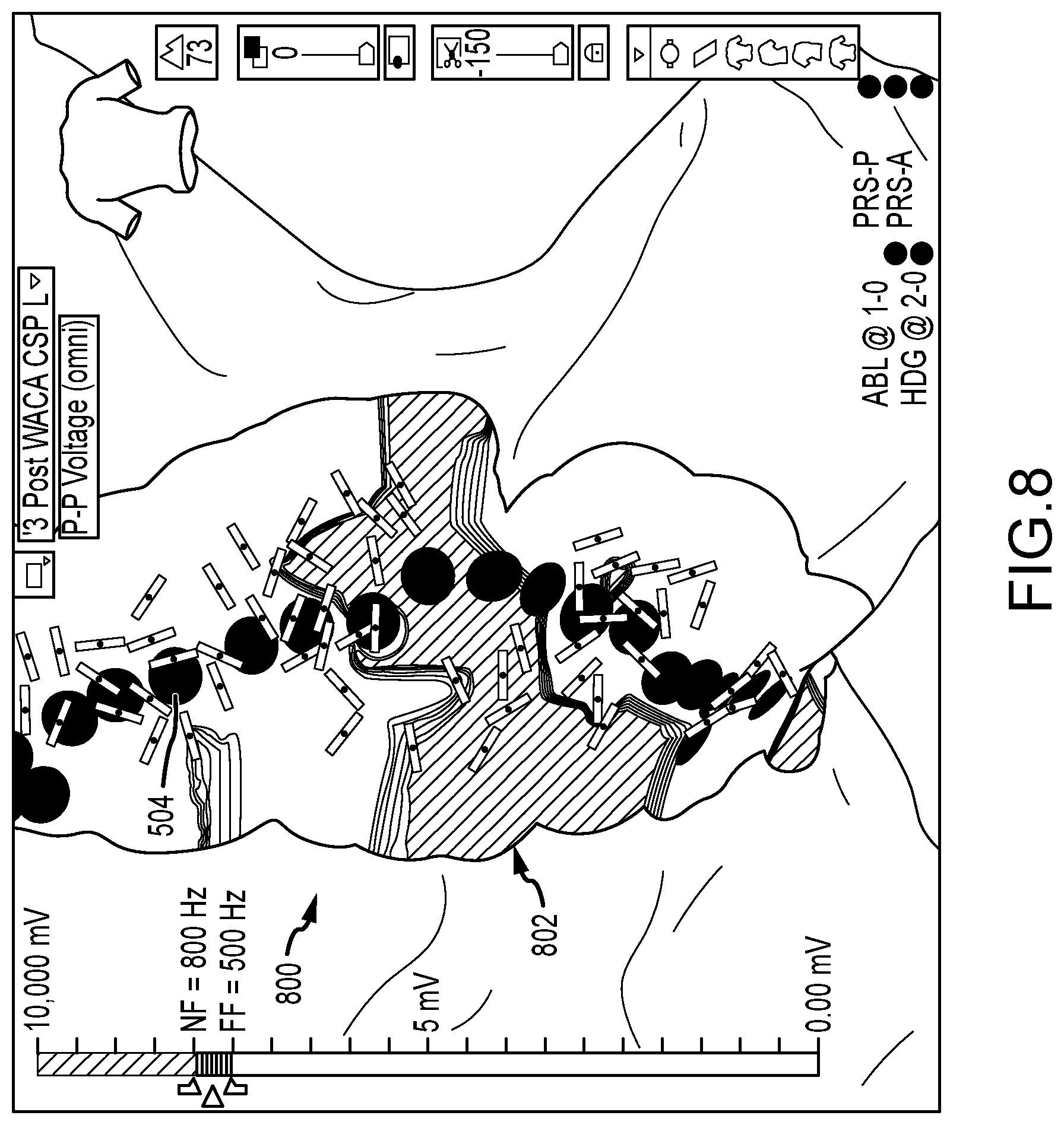 Patent US12167917 Figure 9 – System and method for detection and mapping of near field conduction in scar tissue