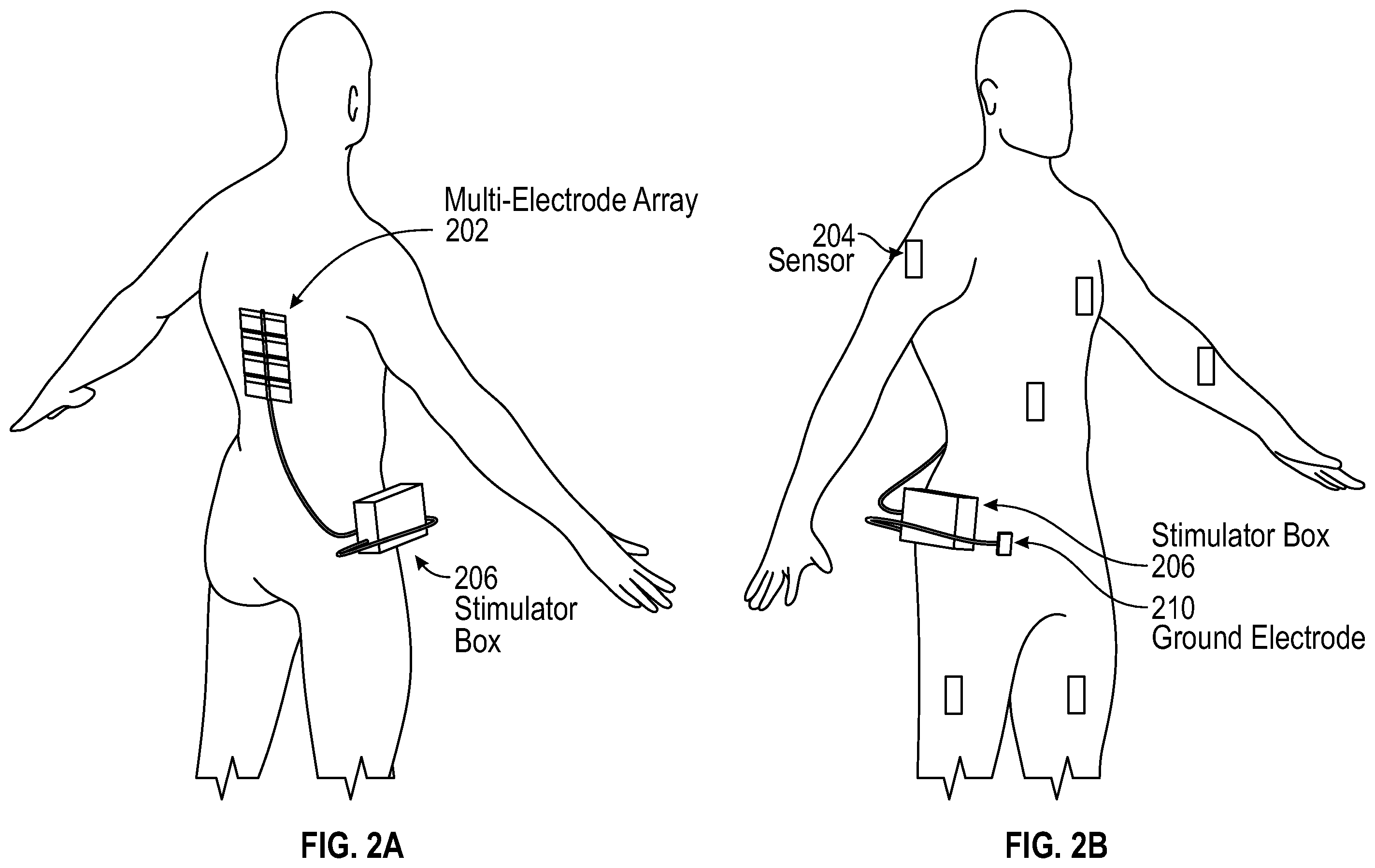 Patent US12167918 Figure 2 – Method and system for targeted and adaptive transcutaneous spinal cord stimulation
