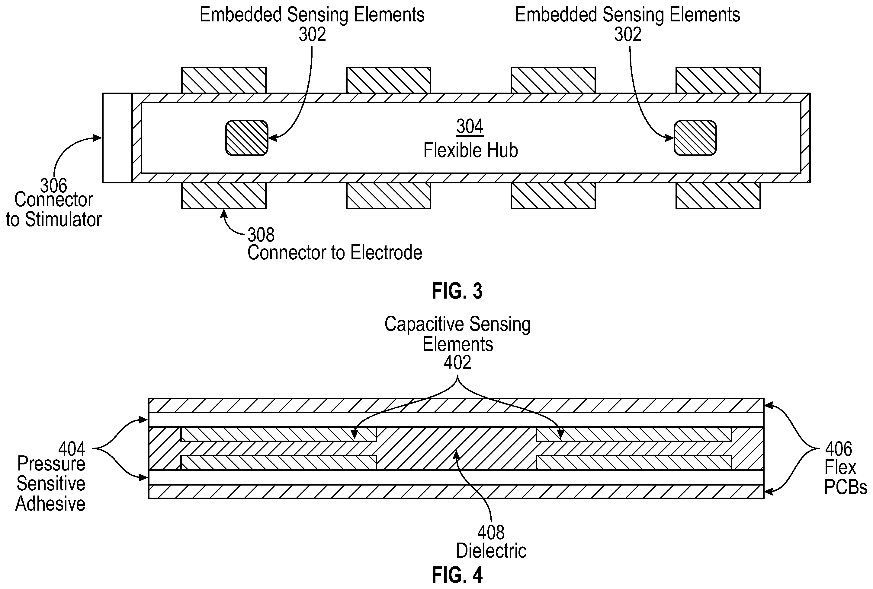 Patent US12167918 Figure 3 – Method and system for targeted and adaptive transcutaneous spinal cord stimulation