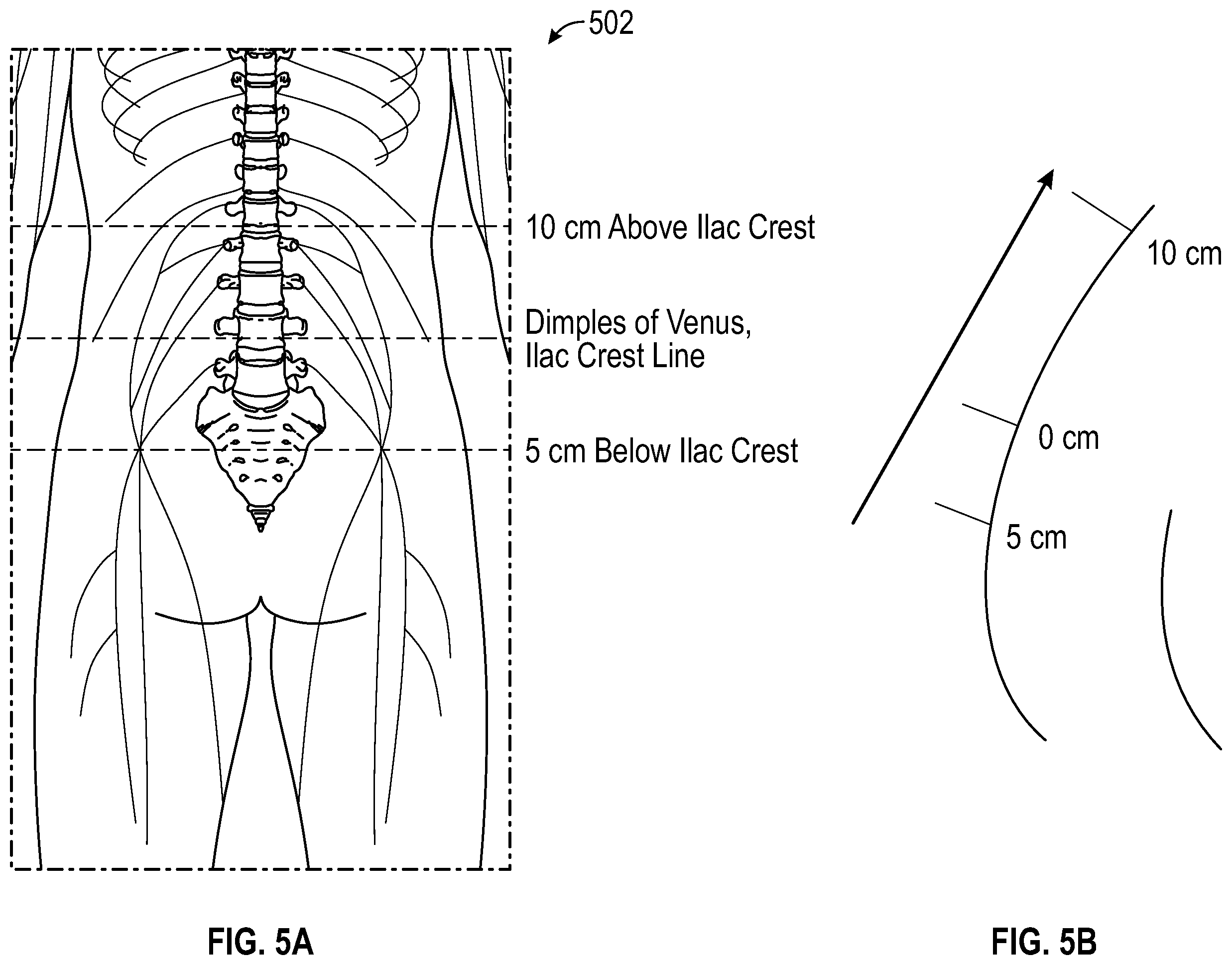 Patent US12167918 Figure 4 – Method and system for targeted and adaptive transcutaneous spinal cord stimulation