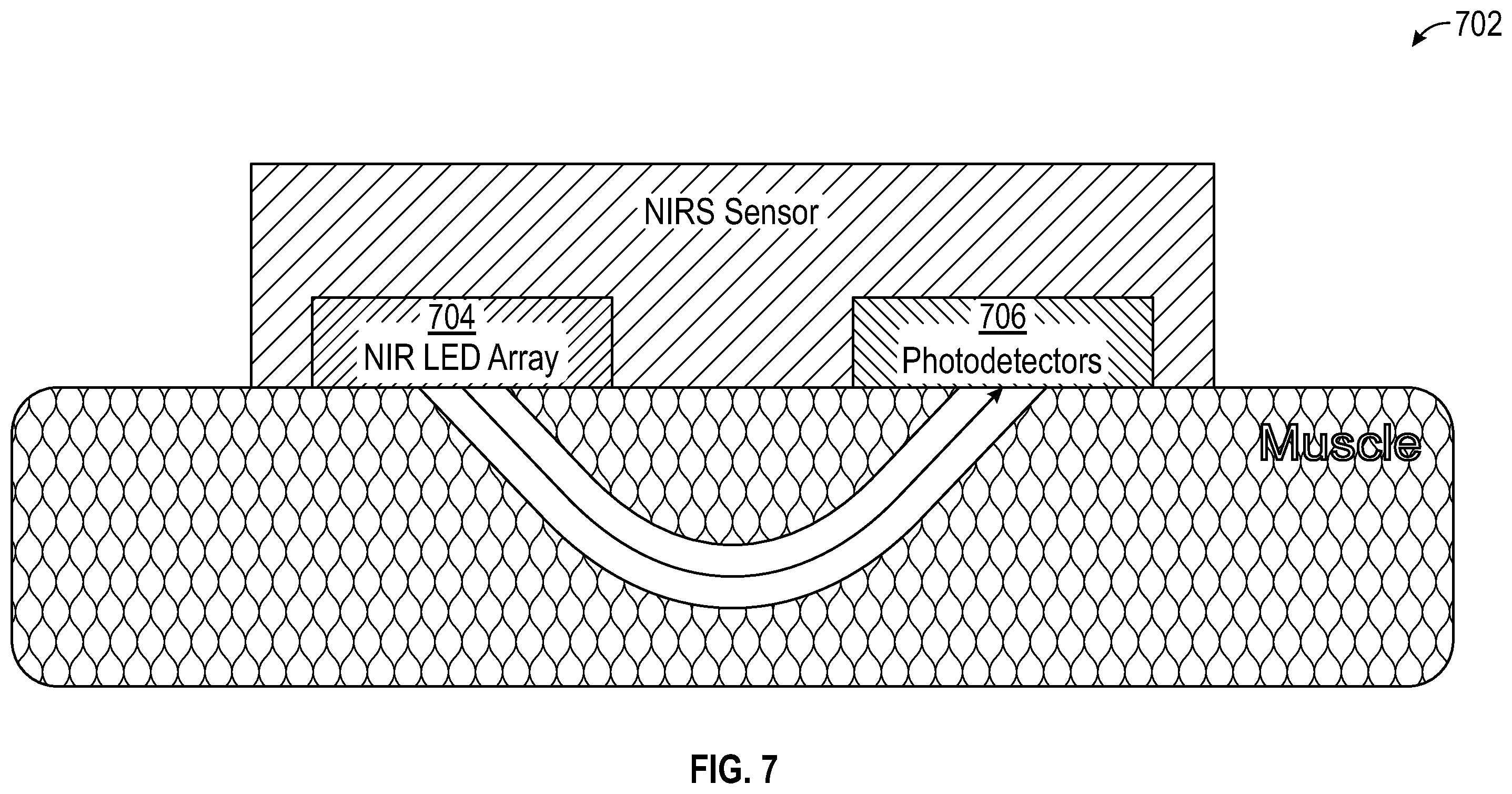 Patent US12167918 Figure 6 – Method and system for targeted and adaptive transcutaneous spinal cord stimulation