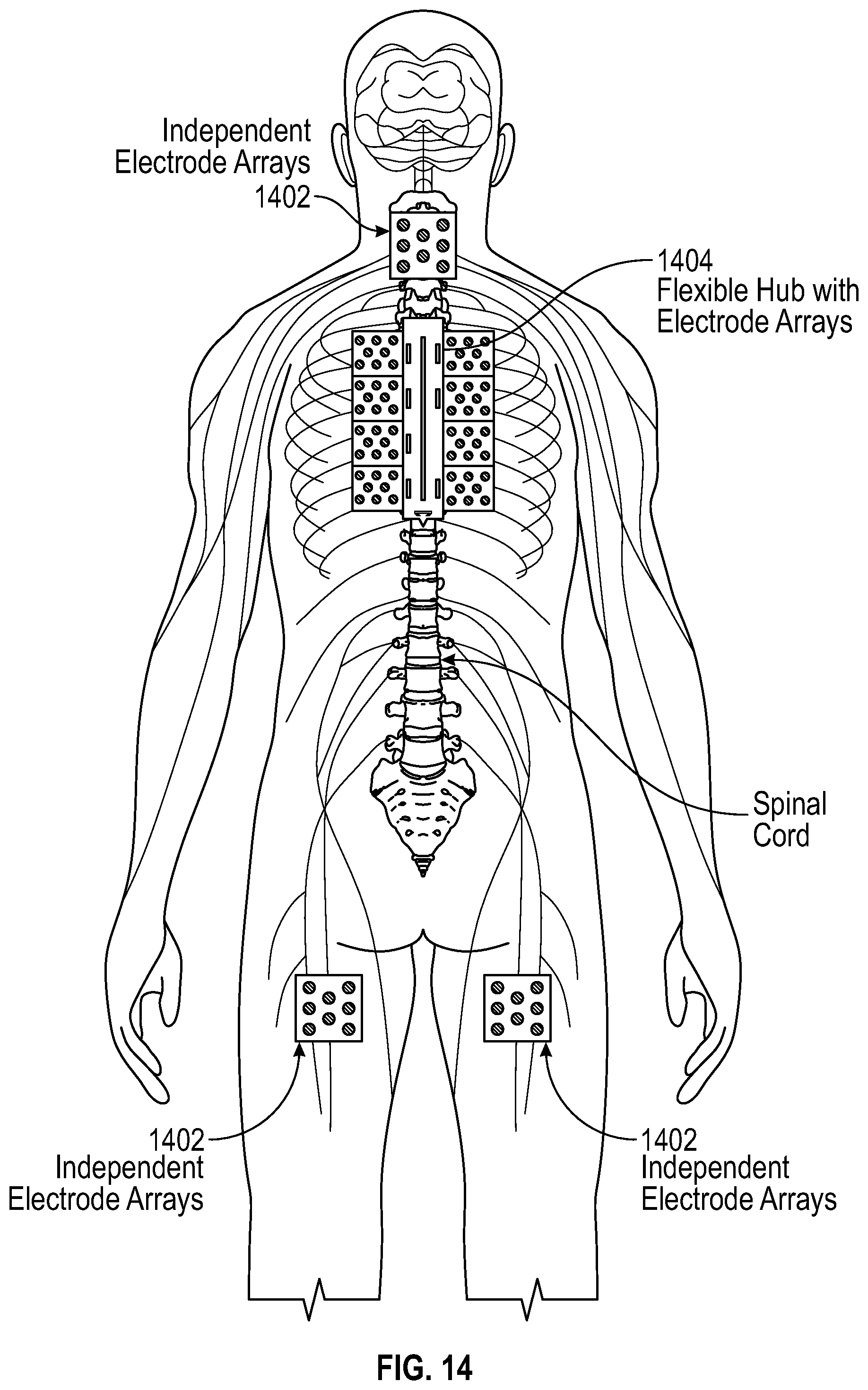Patent US12167918 Figure 12 – Method and system for targeted and adaptive transcutaneous spinal cord stimulation