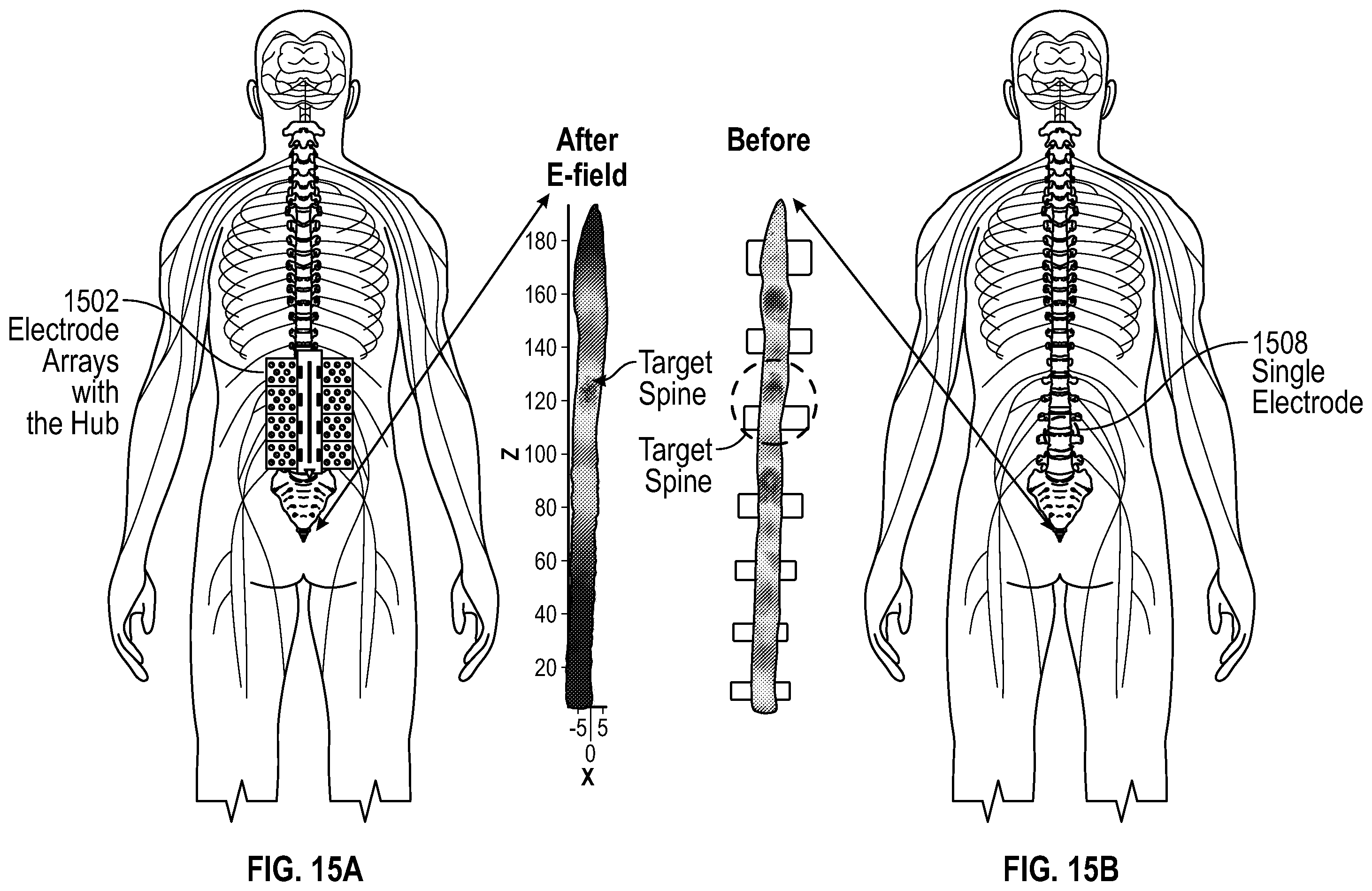 Patent US12167918 Figure 13 – Method and system for targeted and adaptive transcutaneous spinal cord stimulation