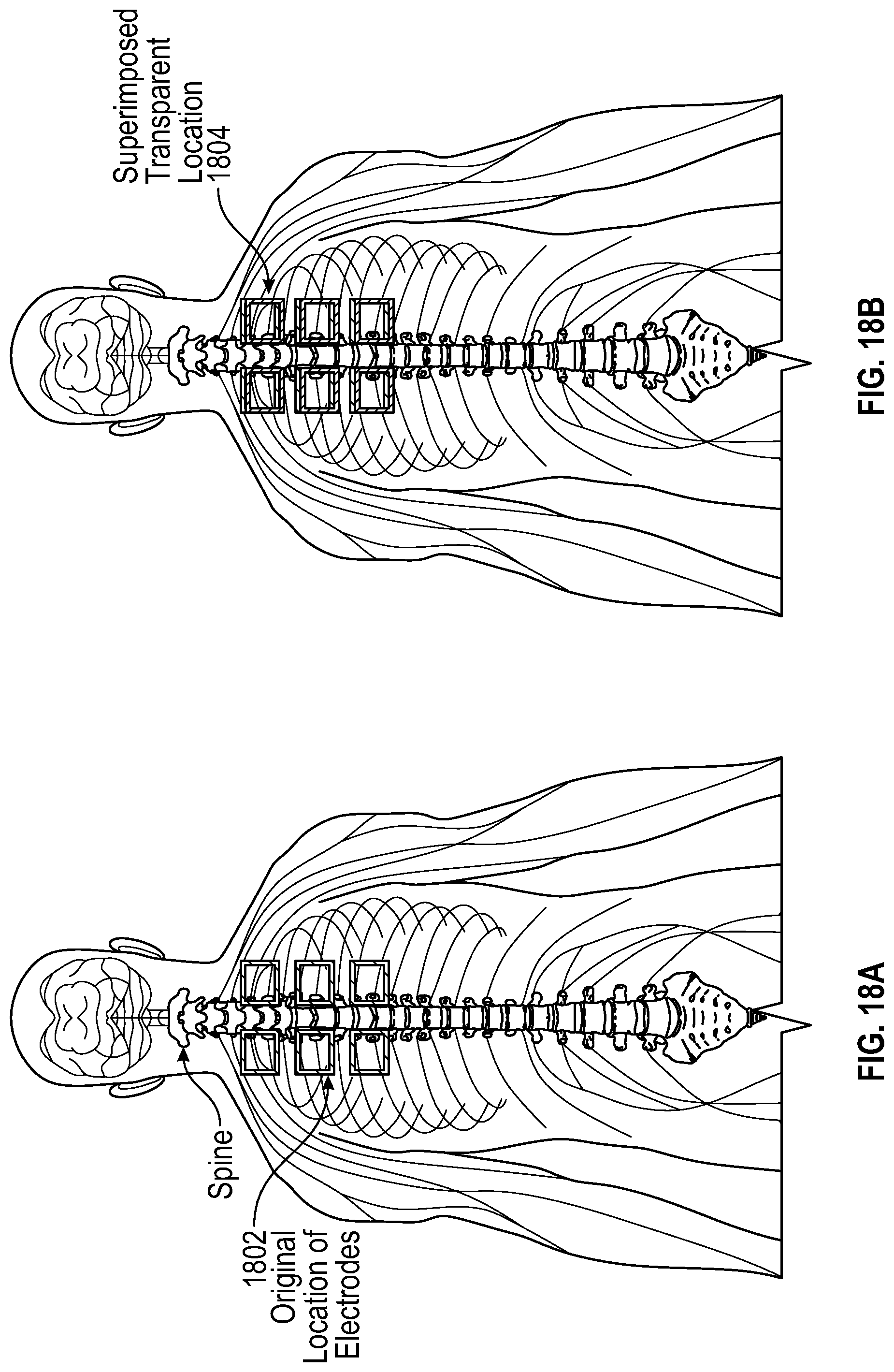 Patent US12167918 Figure 16 – Method and system for targeted and adaptive transcutaneous spinal cord stimulation
