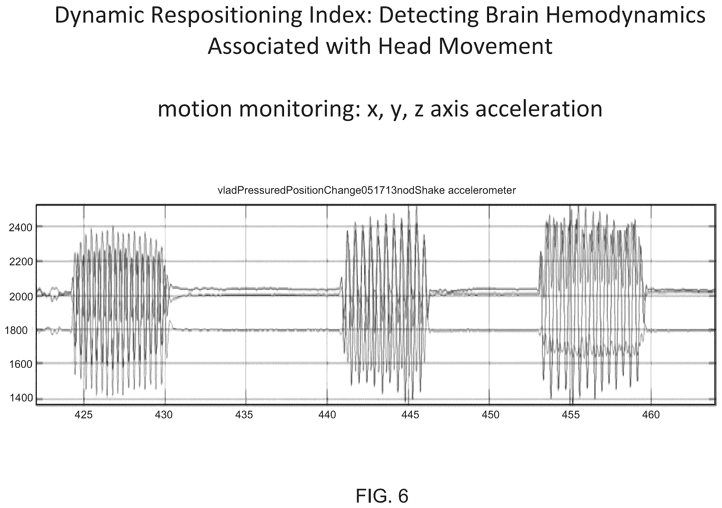Patent US12167919 Figure 6 – System and method for non-invasive, intracranial brain motion monitoring