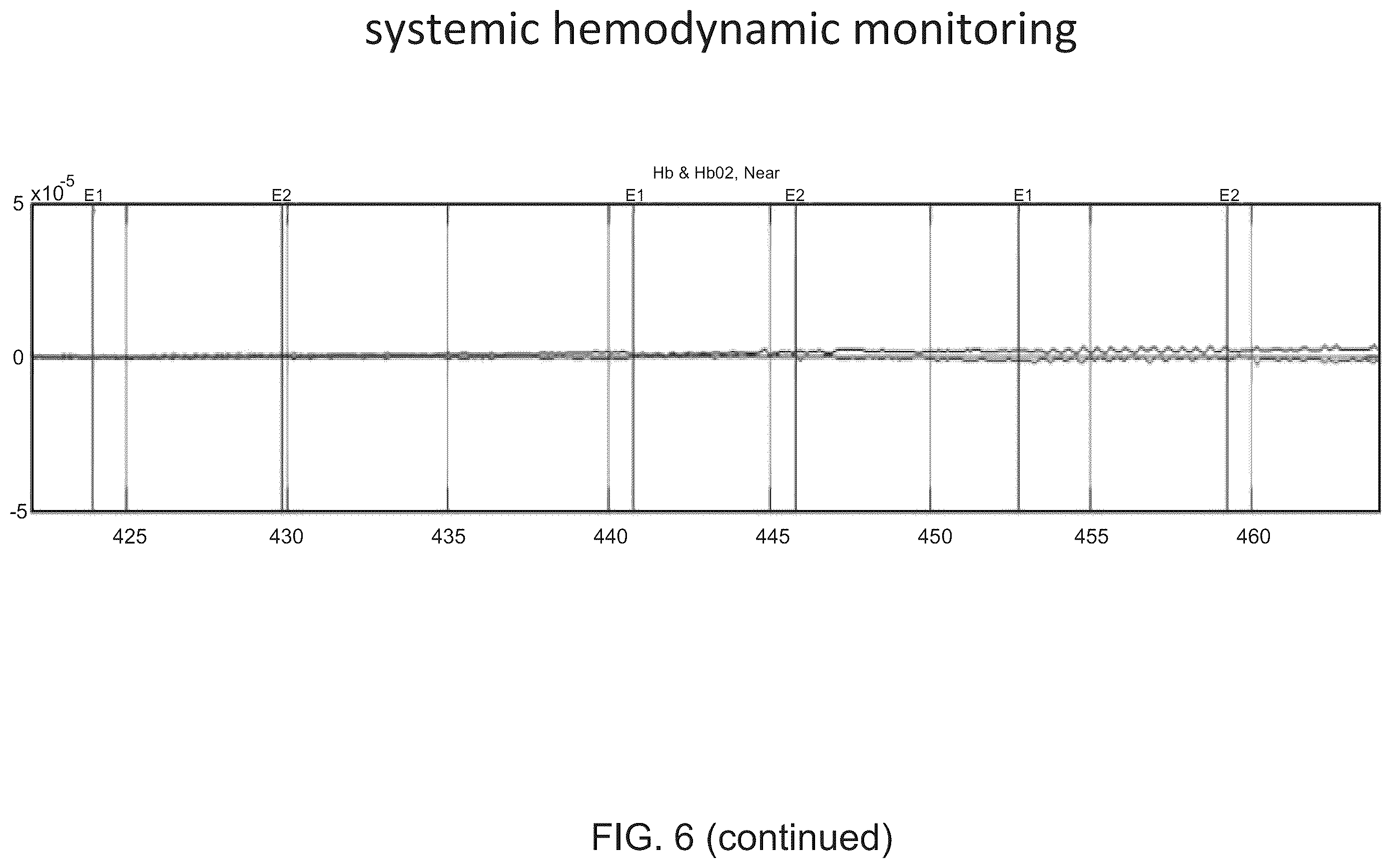 Patent US12167919 Figure 7 – System and method for non-invasive, intracranial brain motion monitoring