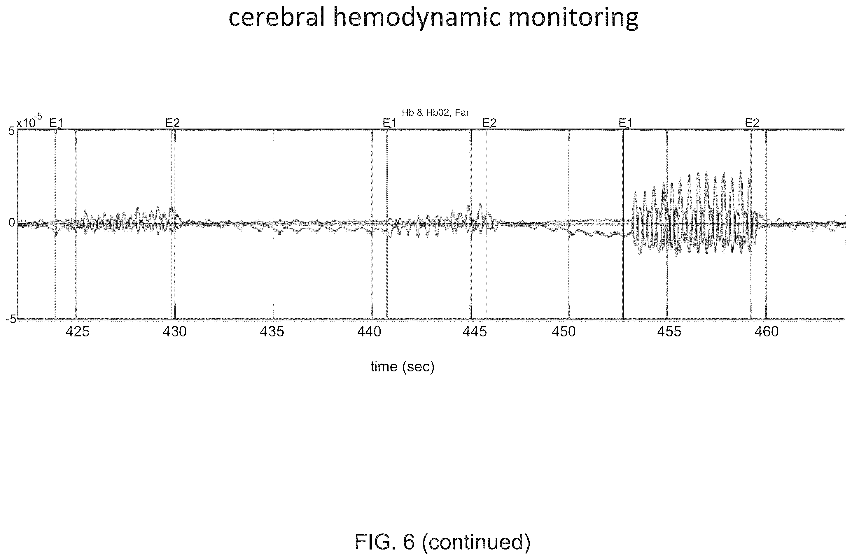 Patent US12167919 Figure 8 – System and method for non-invasive, intracranial brain motion monitoring