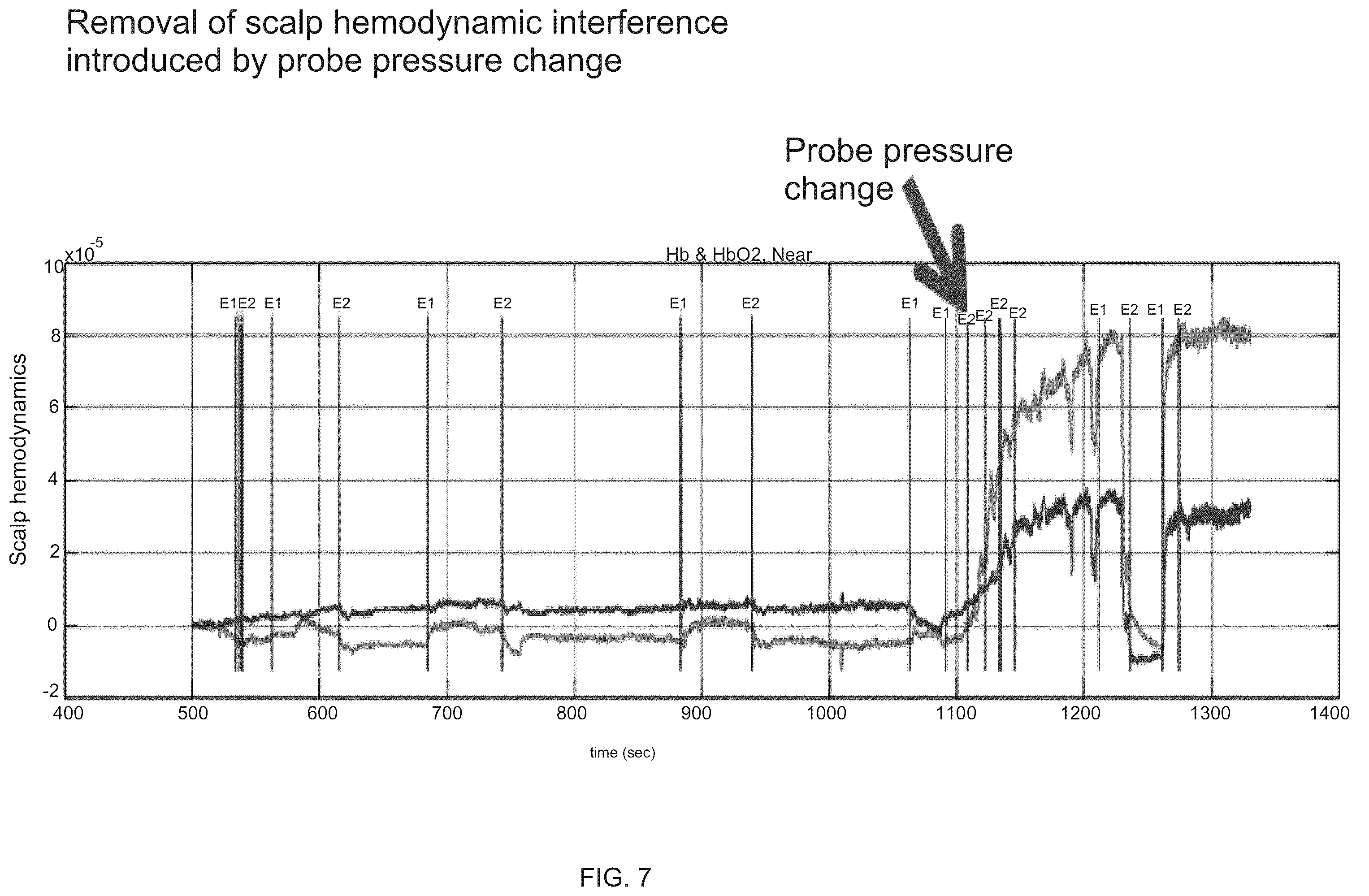 Patent US12167919 Figure 9 – System and method for non-invasive, intracranial brain motion monitoring