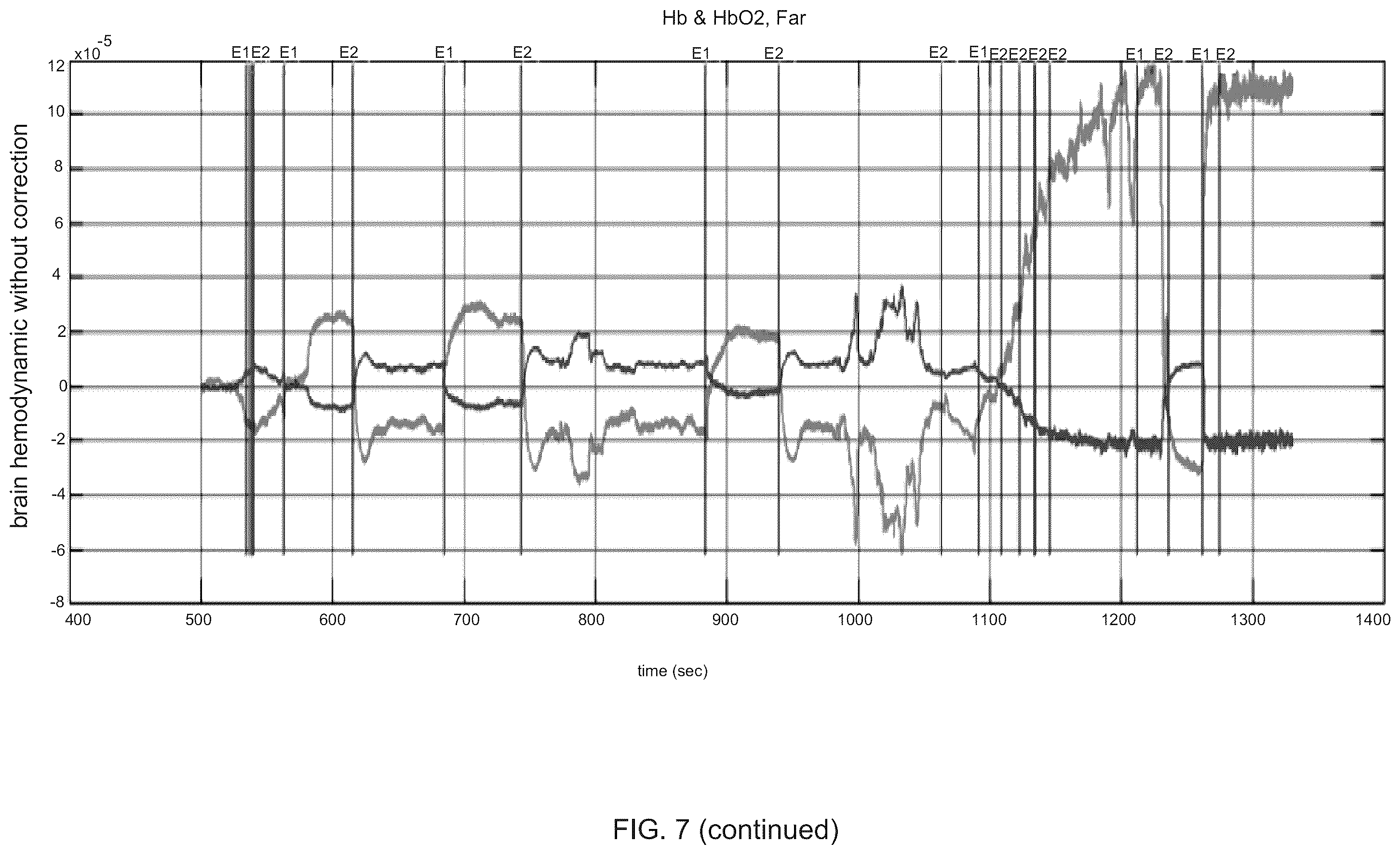 Patent US12167919 Figure 10 – System and method for non-invasive, intracranial brain motion monitoring