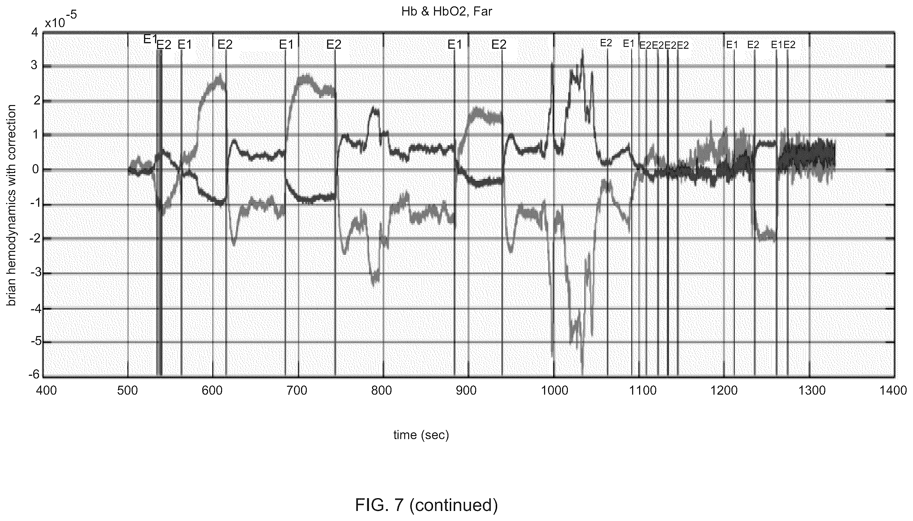 Patent US12167919 Figure 11 – System and method for non-invasive, intracranial brain motion monitoring