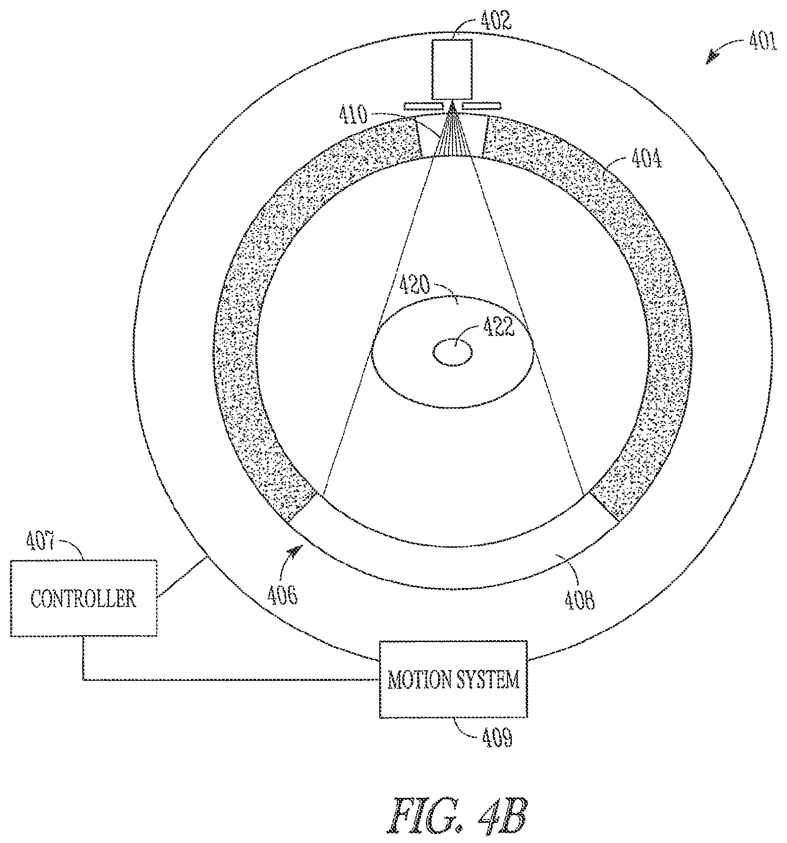 Patent US12167922 Figure 4 – Method and apparatus for emission guided radiation therapy