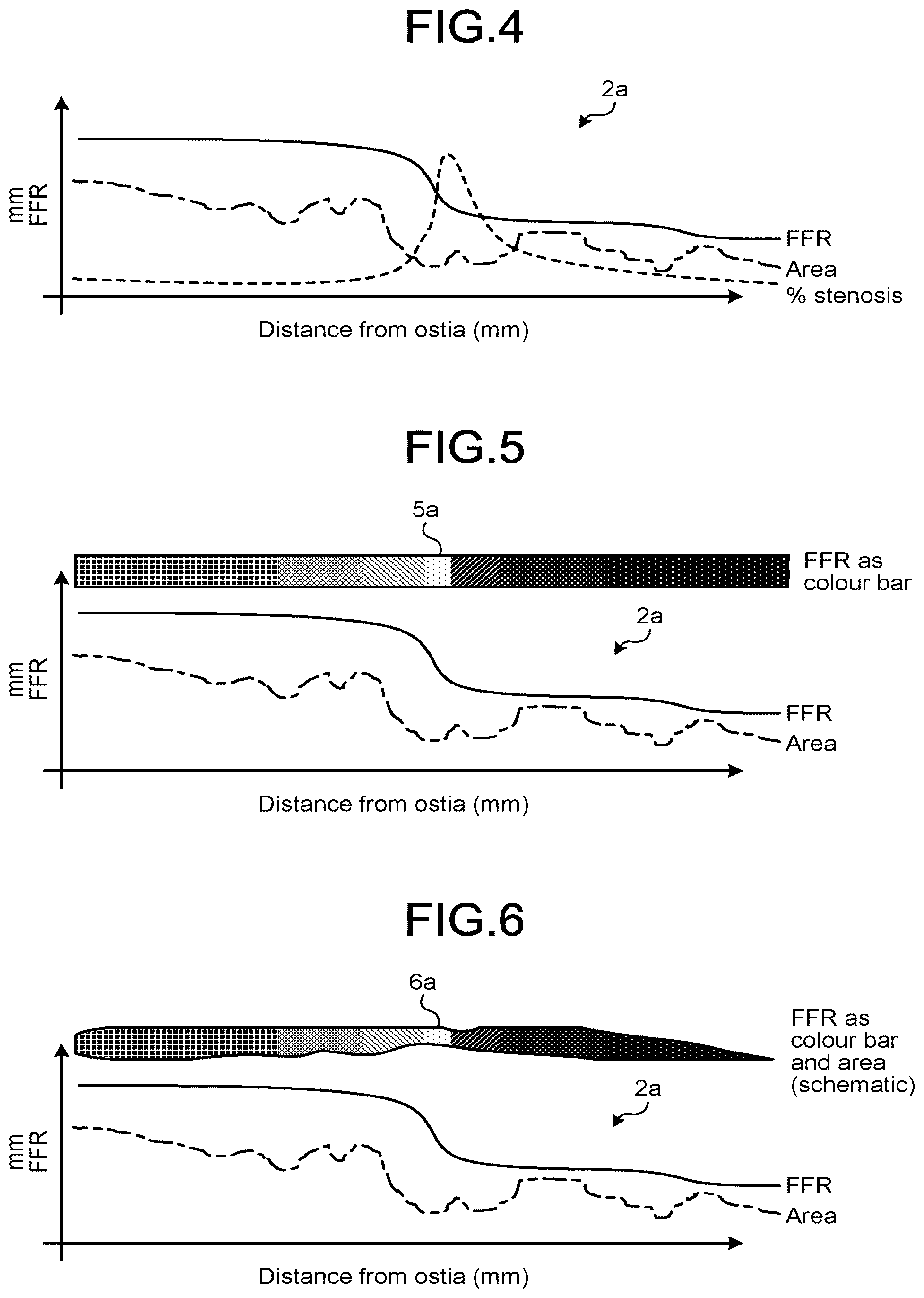 Patent US12167924 Figure 3 – Medical image processing apparatus, recording medium, and system