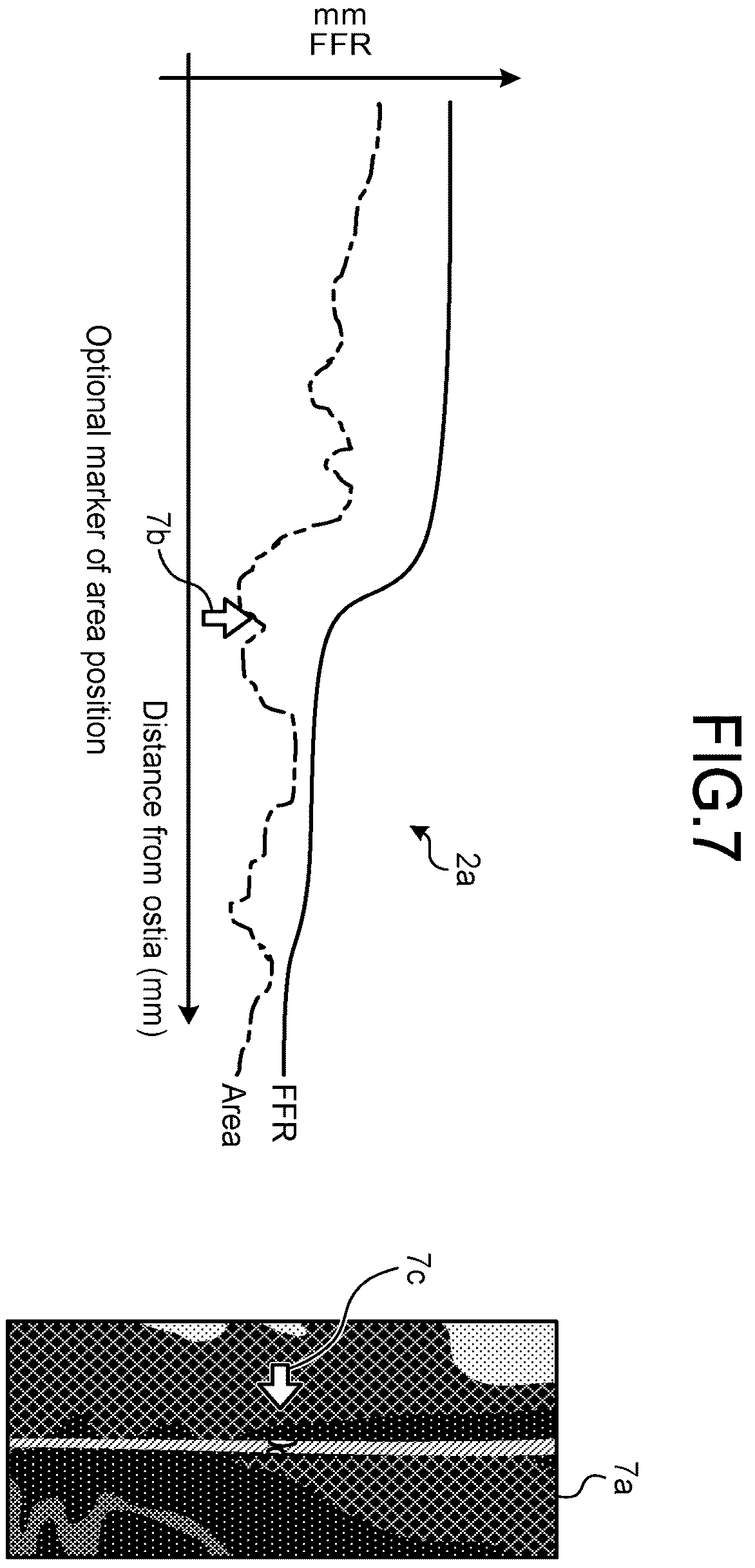 Patent US12167924 Figure 4 – Medical image processing apparatus, recording medium, and system