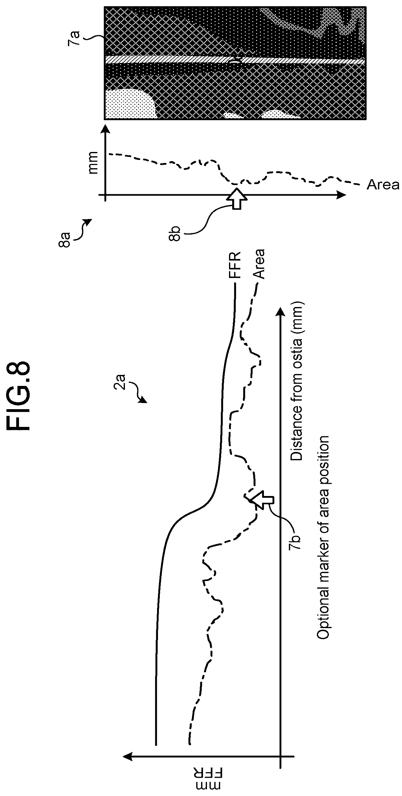 Patent US12167924 Figure 5 – Medical image processing apparatus, recording medium, and system