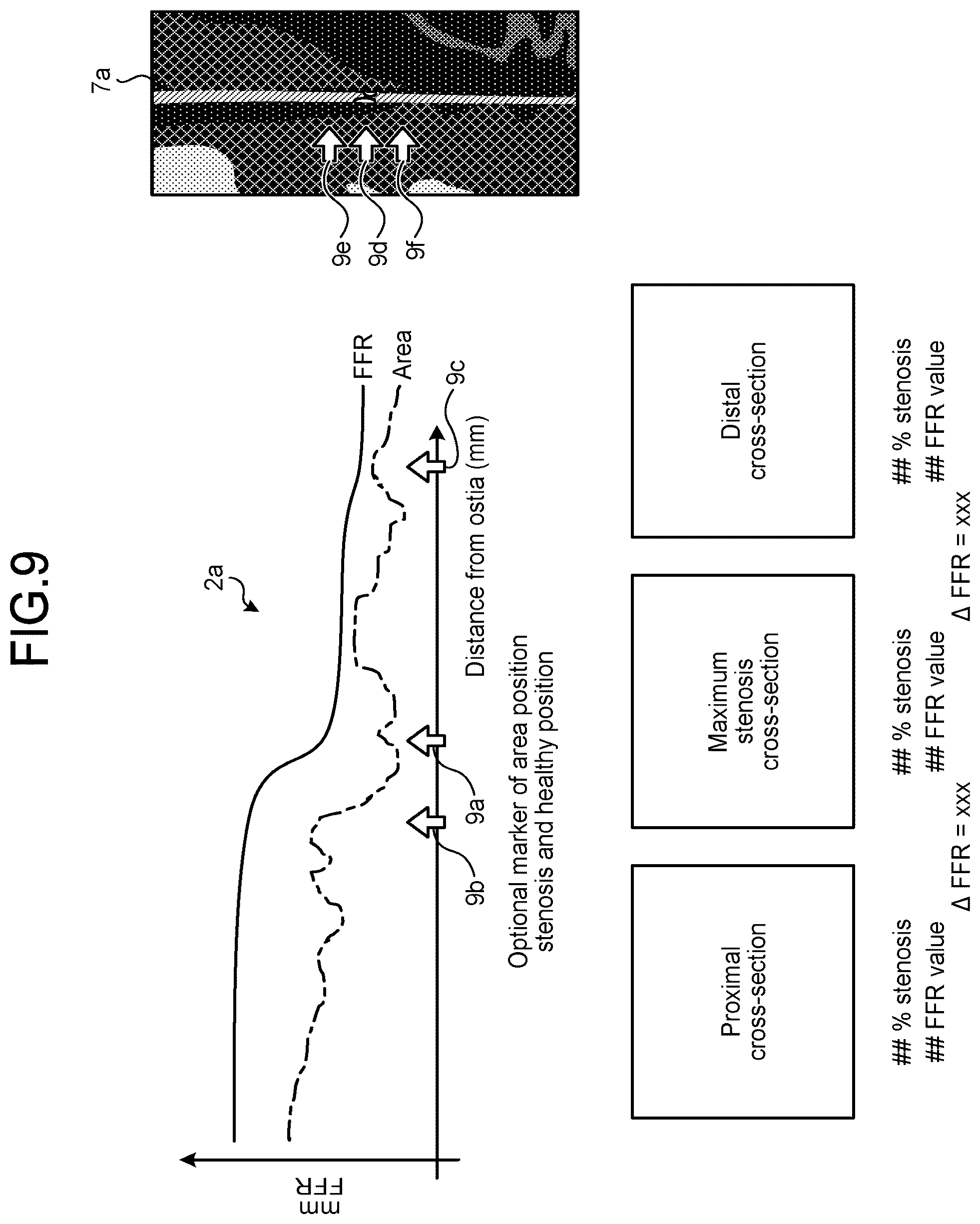 Patent US12167924 Figure 6 – Medical image processing apparatus, recording medium, and system