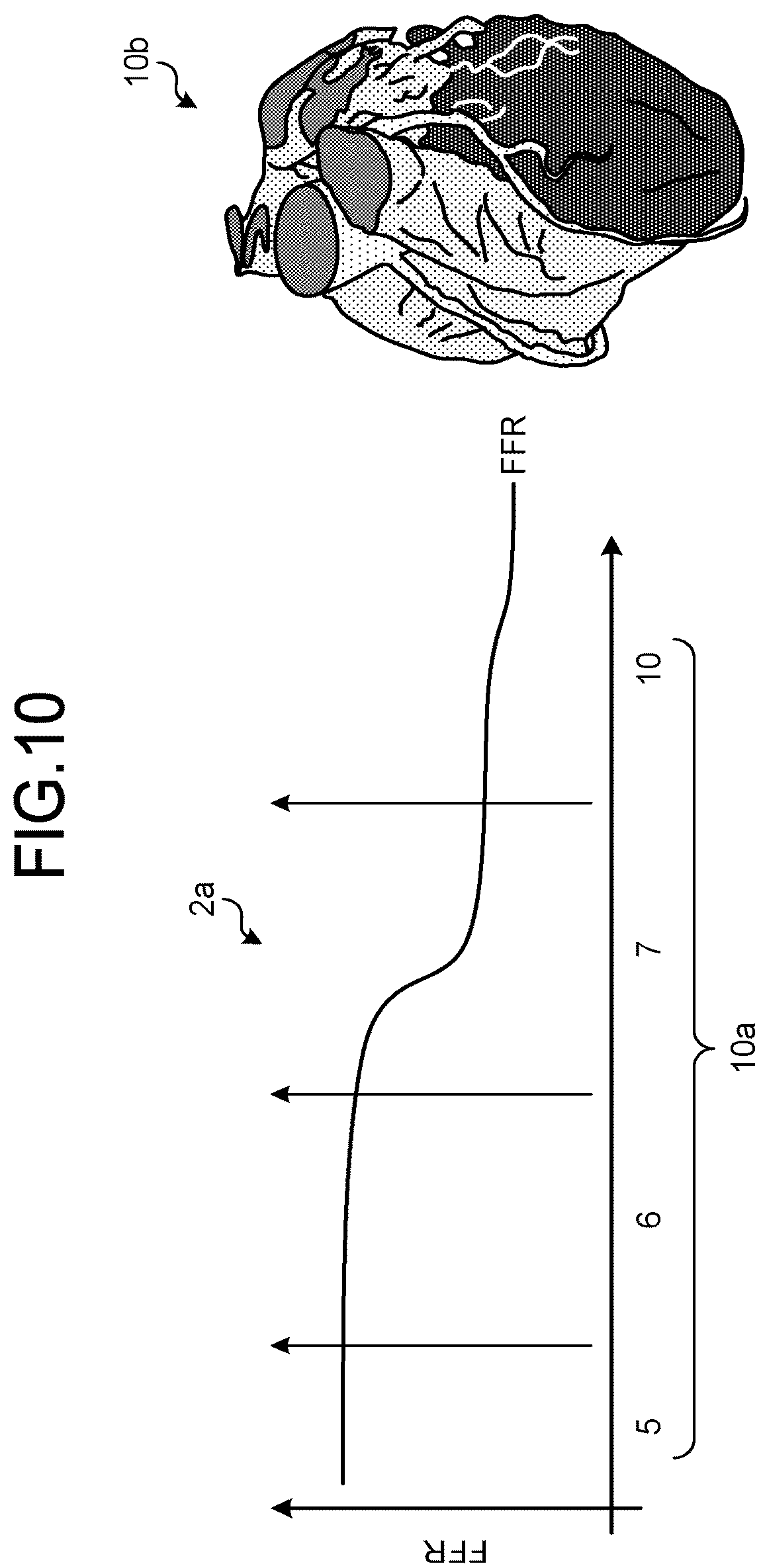 Patent US12167924 Figure 7 – Medical image processing apparatus, recording medium, and system