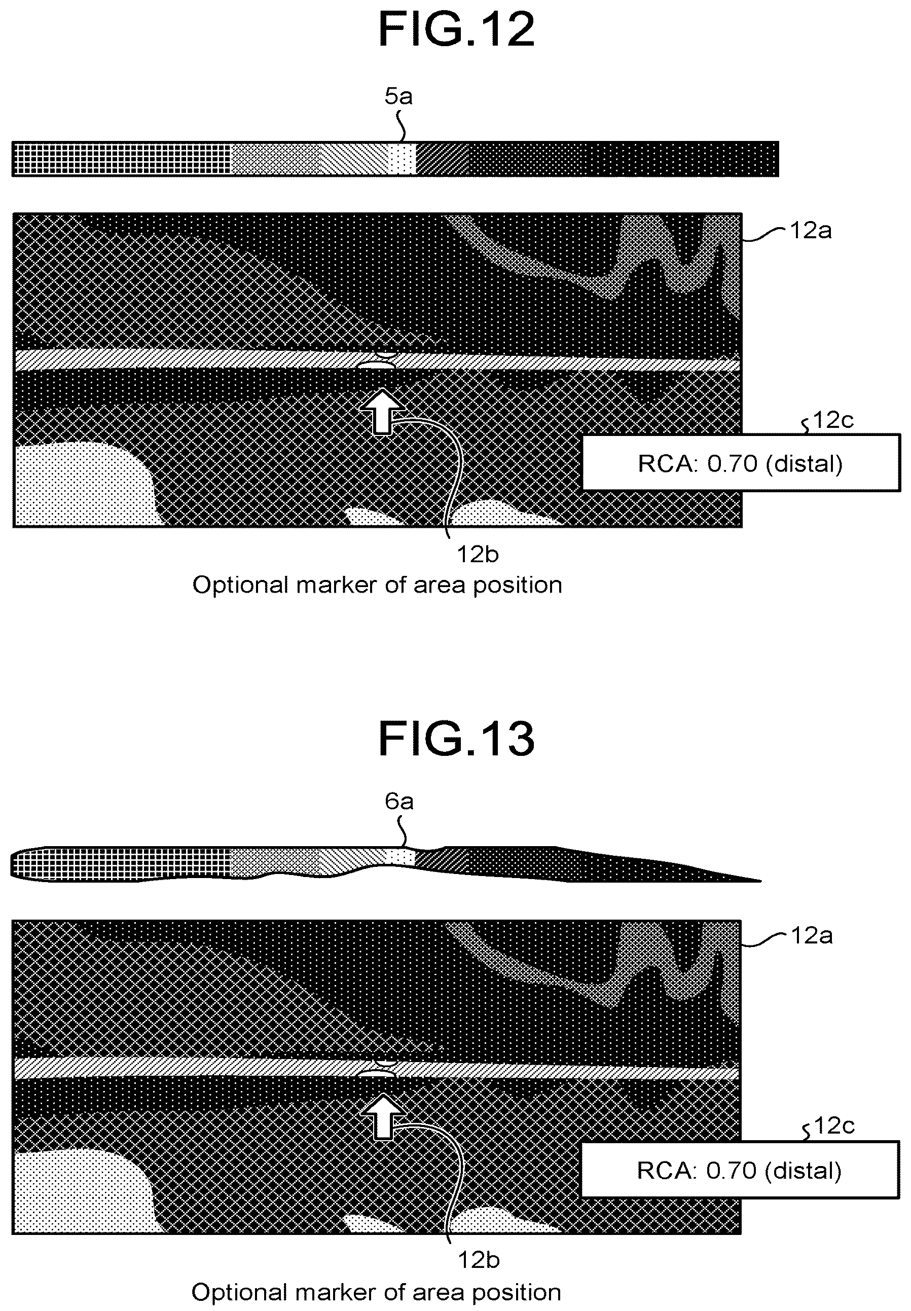 Patent US12167924 Figure 9 – Medical image processing apparatus, recording medium, and system