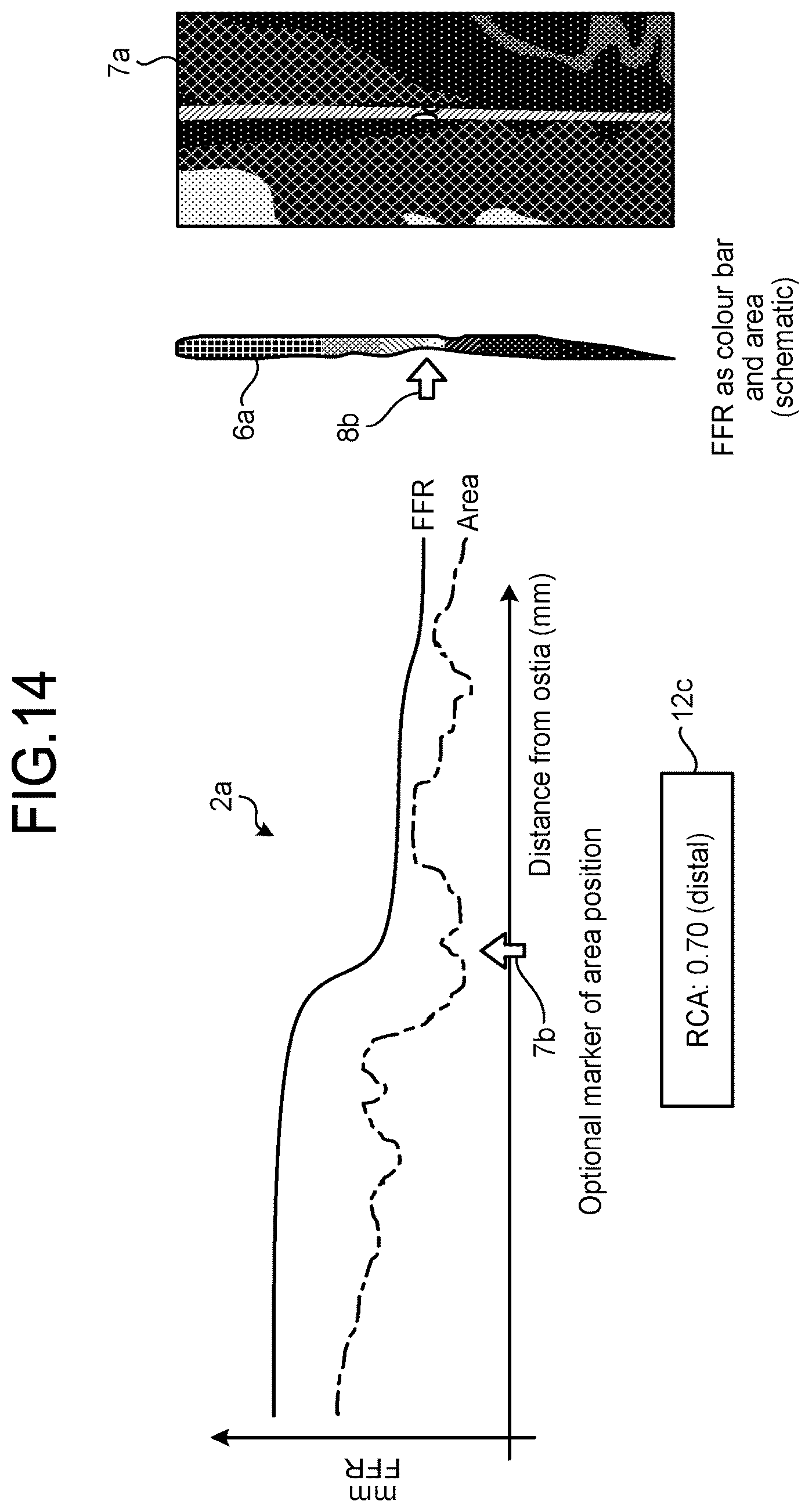 Patent US12167924 Figure 10 – Medical image processing apparatus, recording medium, and system