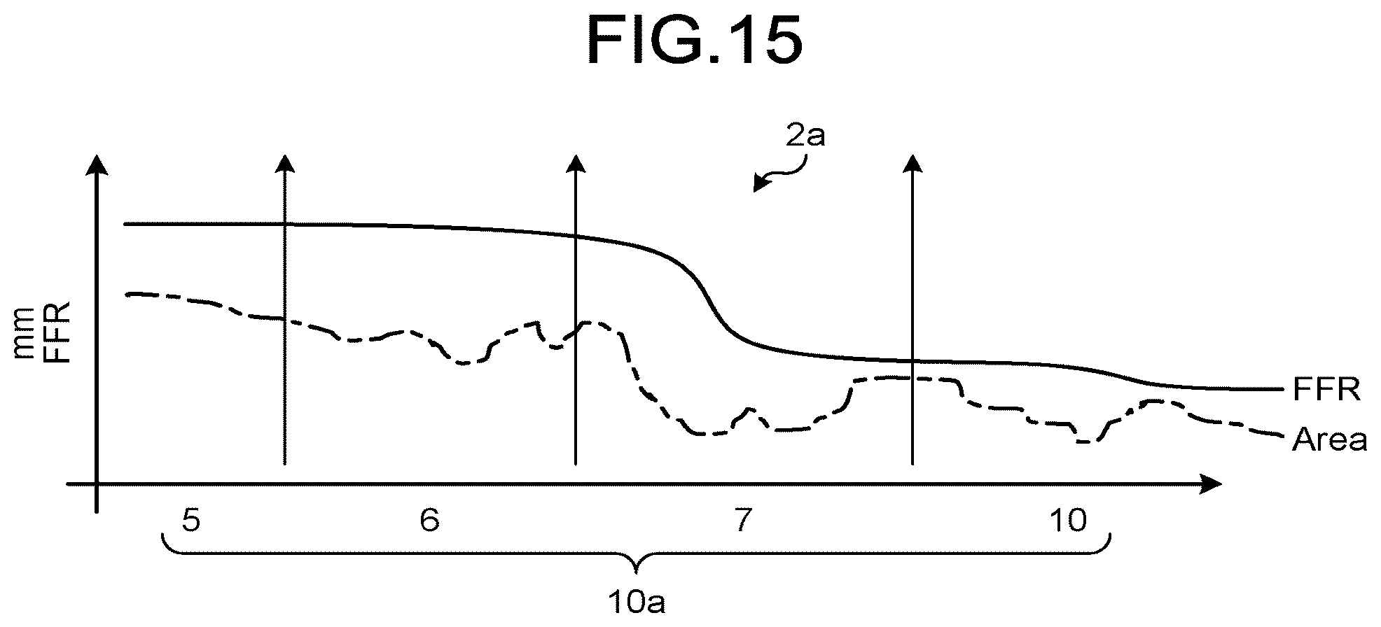 Patent US12167924 Figure 11 – Medical image processing apparatus, recording medium, and system