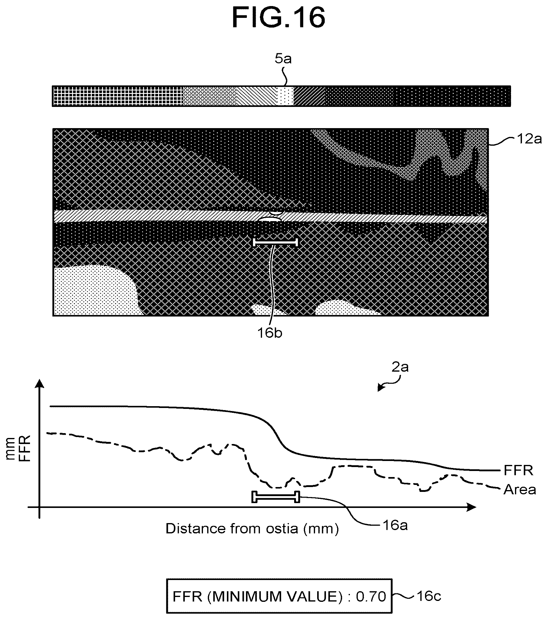Patent US12167924 Figure 12 – Medical image processing apparatus, recording medium, and system