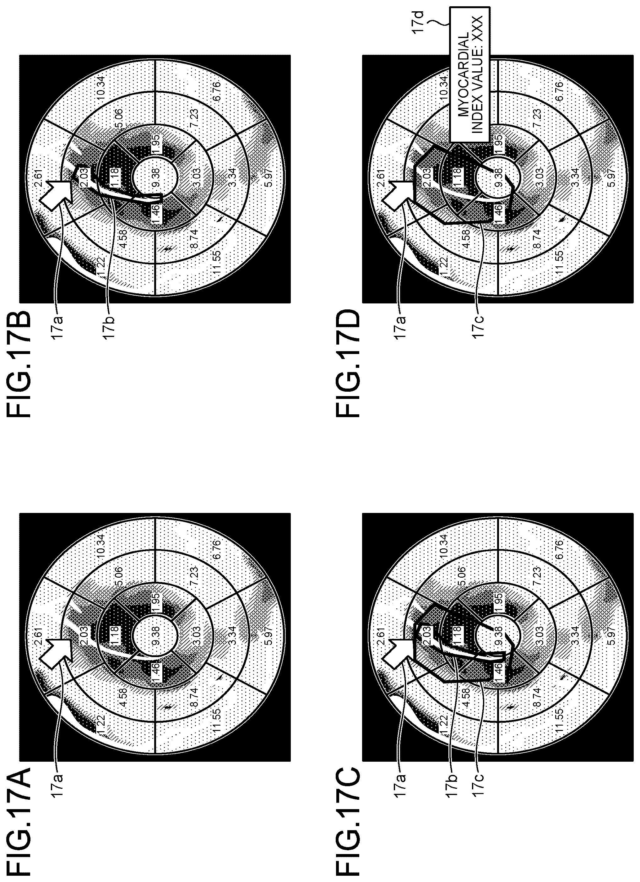 Patent US12167924 Figure 13 – Medical image processing apparatus, recording medium, and system