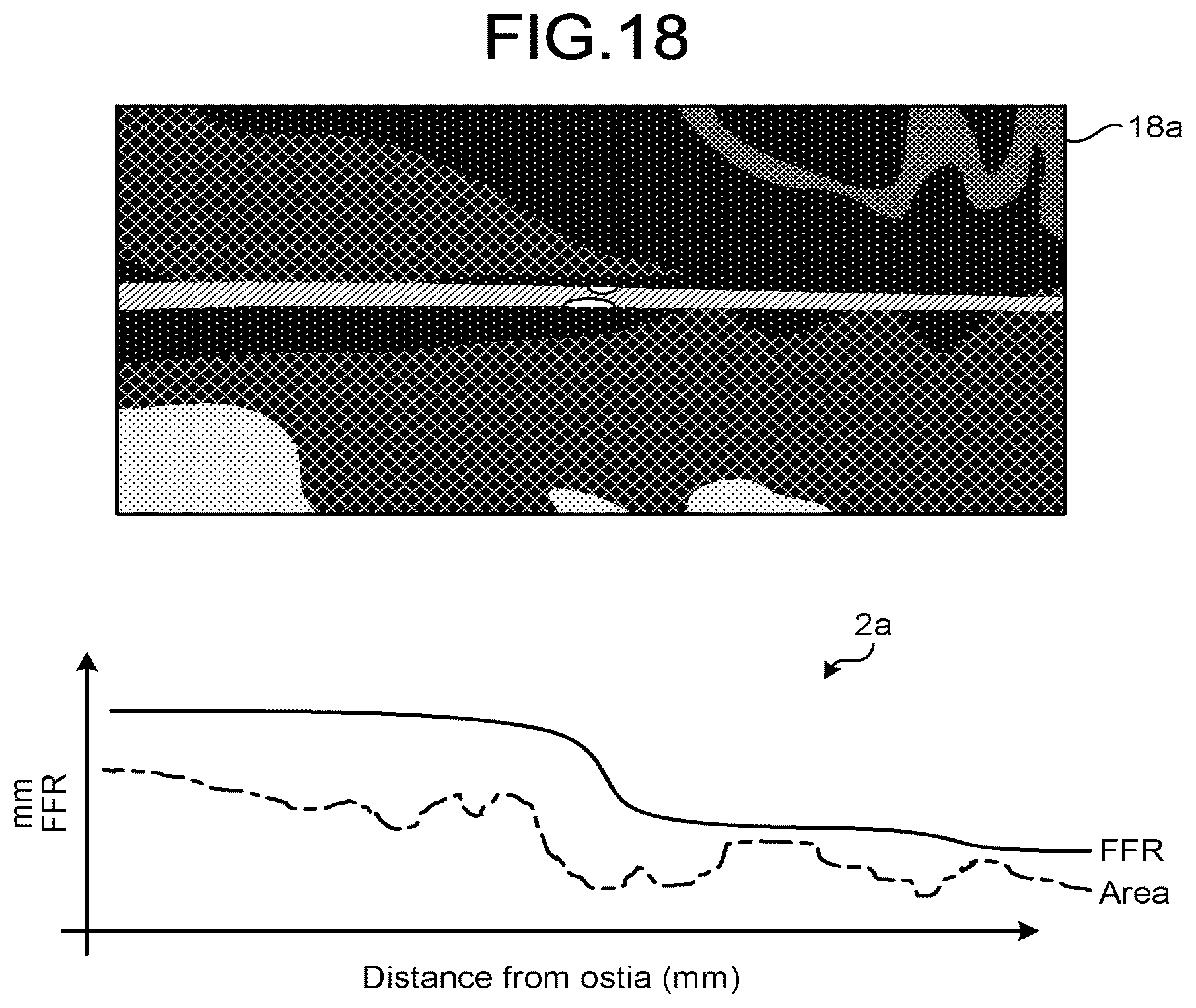 Patent US12167924 Figure 14 – Medical image processing apparatus, recording medium, and system