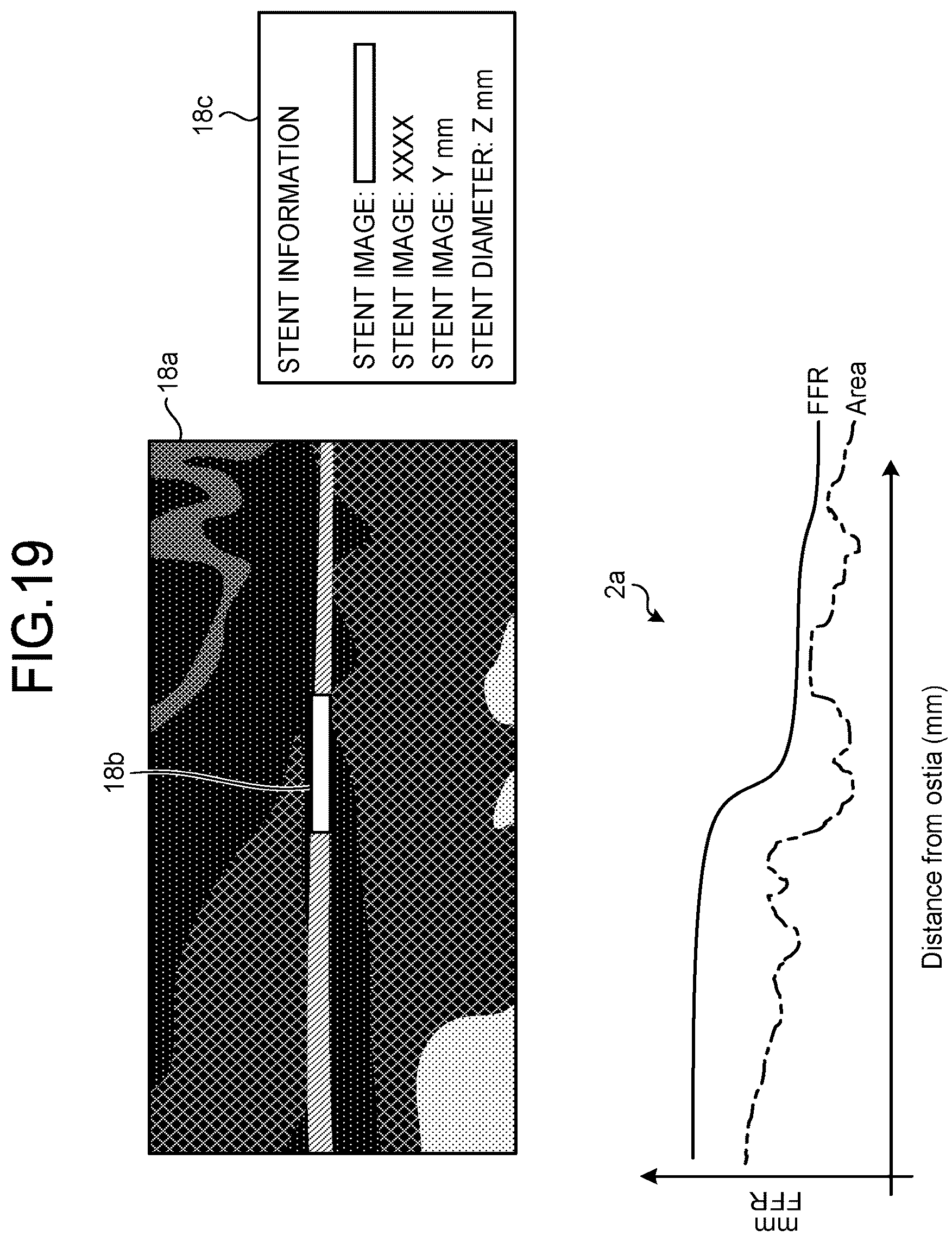 Patent US12167924 Figure 15 – Medical image processing apparatus, recording medium, and system
