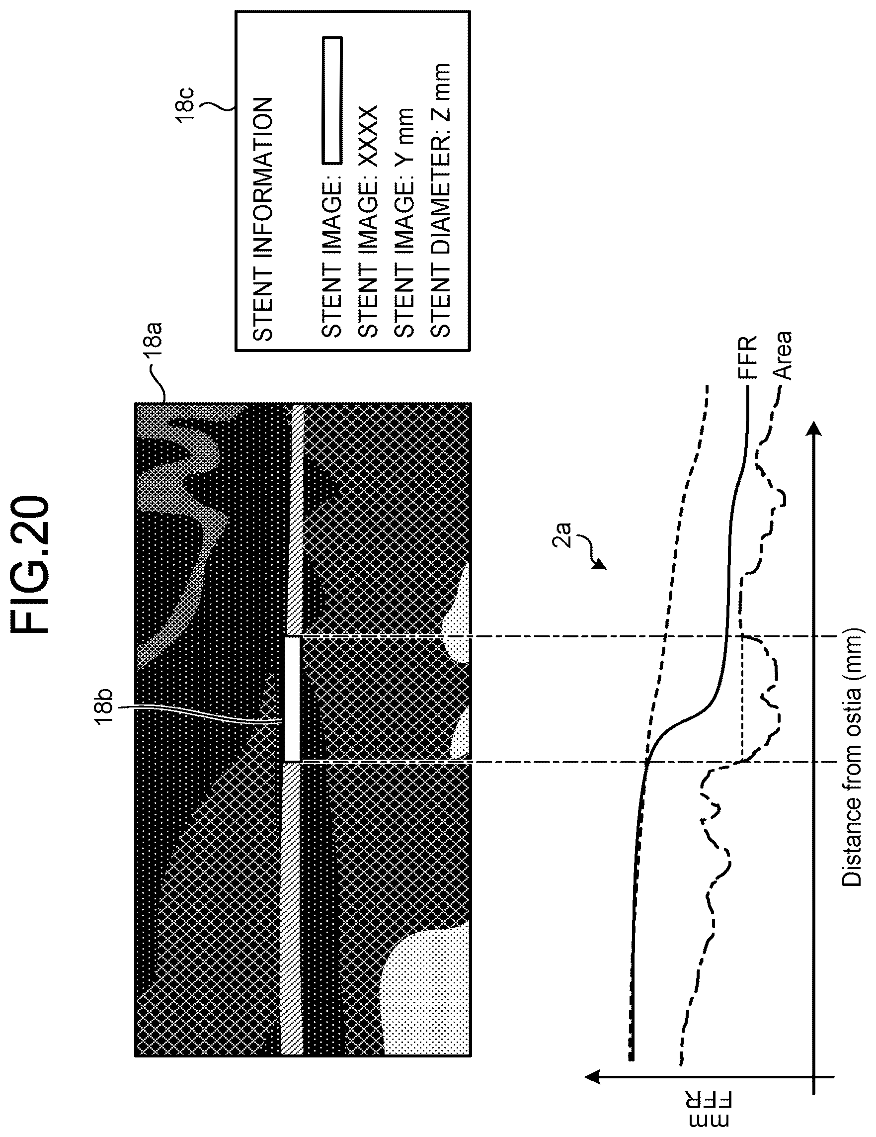 Patent US12167924 Figure 16 – Medical image processing apparatus, recording medium, and system