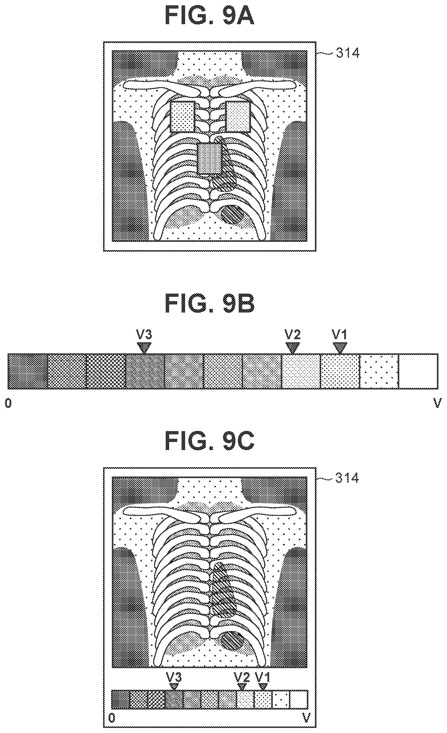 Patent US12167926 Figure 9 – Radiographic system, control apparatus, radiographic method, and storage medium