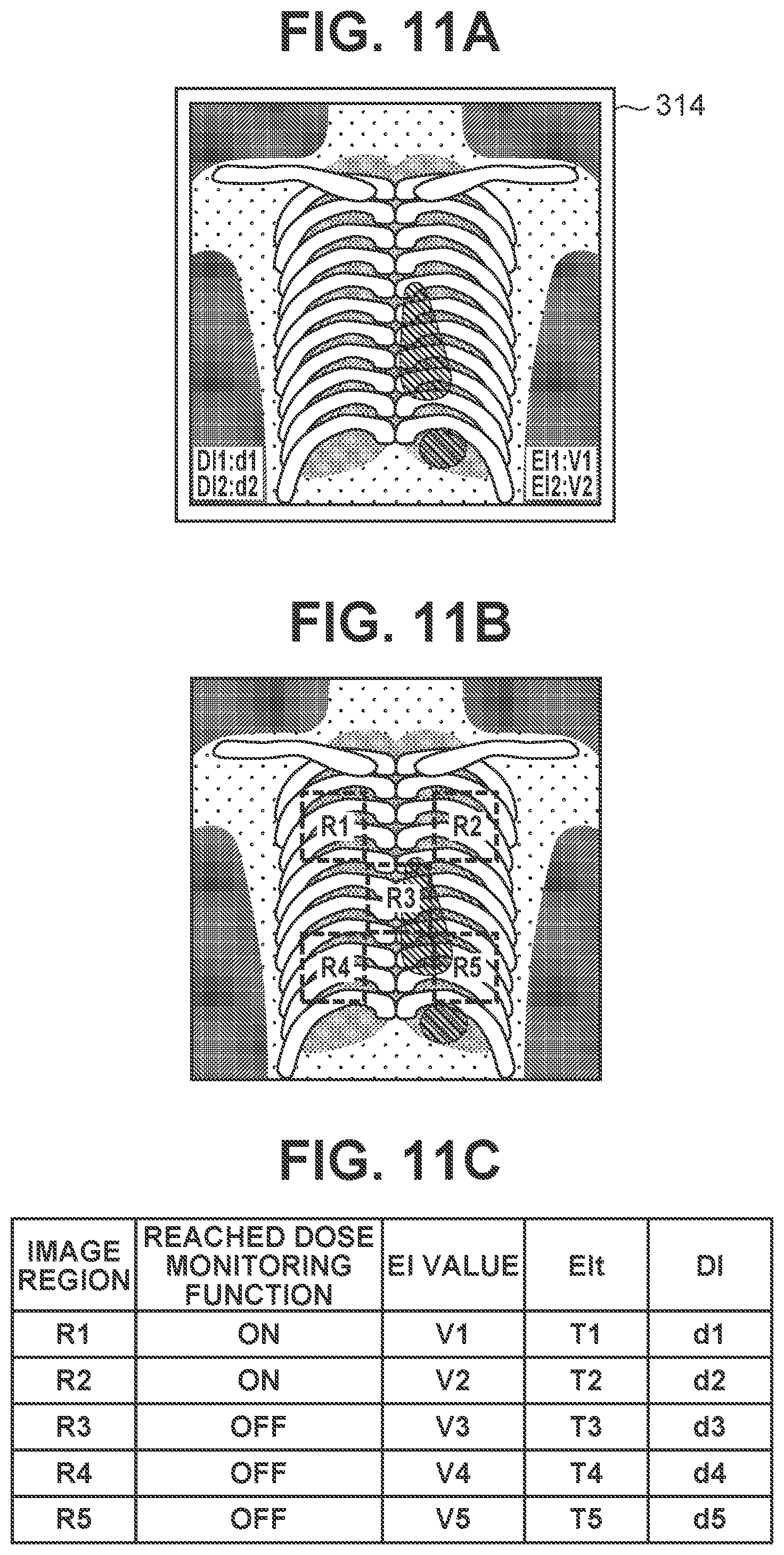 Patent US12167926 Figure 11 – Radiographic system, control apparatus, radiographic method, and storage medium