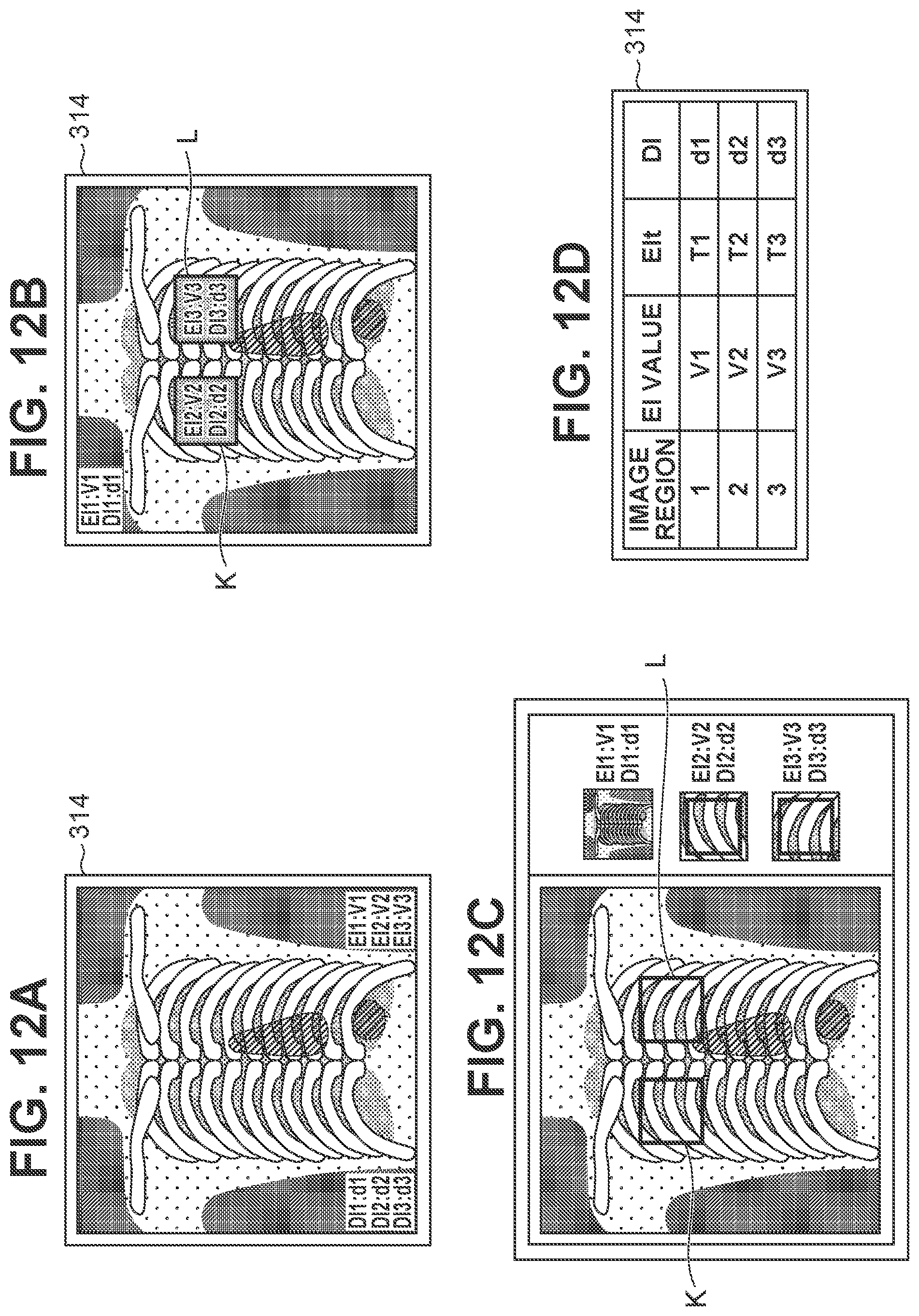 Patent US12167926 Figure 12 – Radiographic system, control apparatus, radiographic method, and storage medium