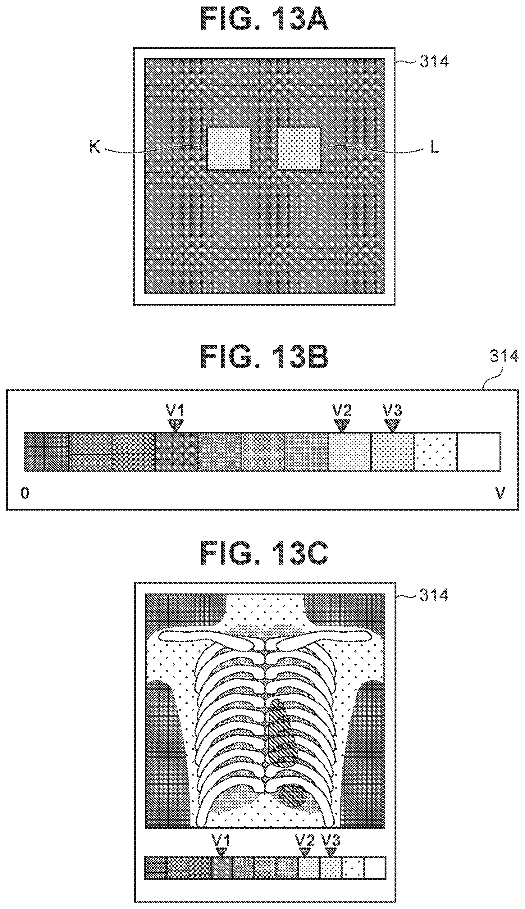 Patent US12167926 Figure 13 – Radiographic system, control apparatus, radiographic method, and storage medium