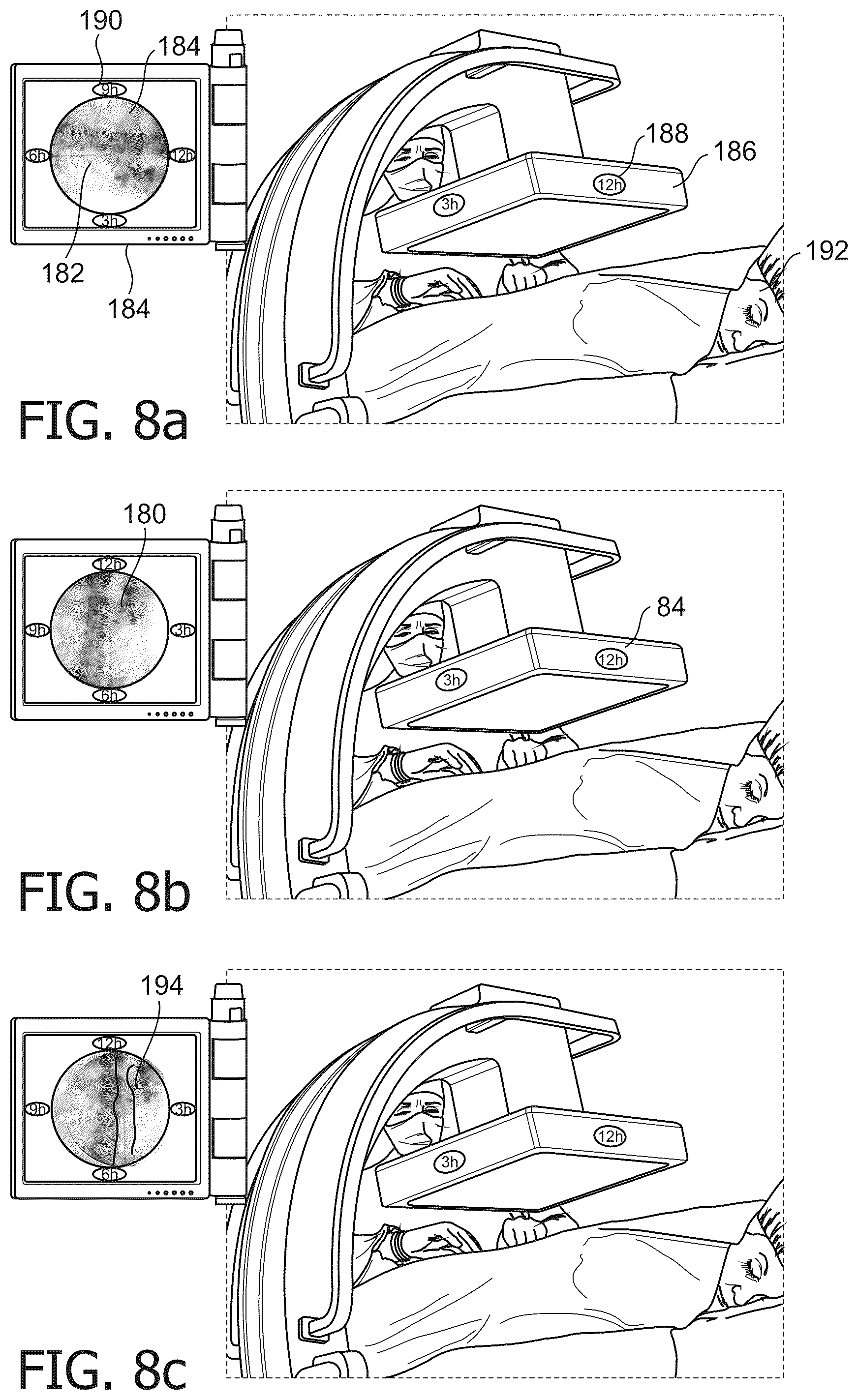 Patent US12167929 Figure 7 – Orientation reference system for medical imaging